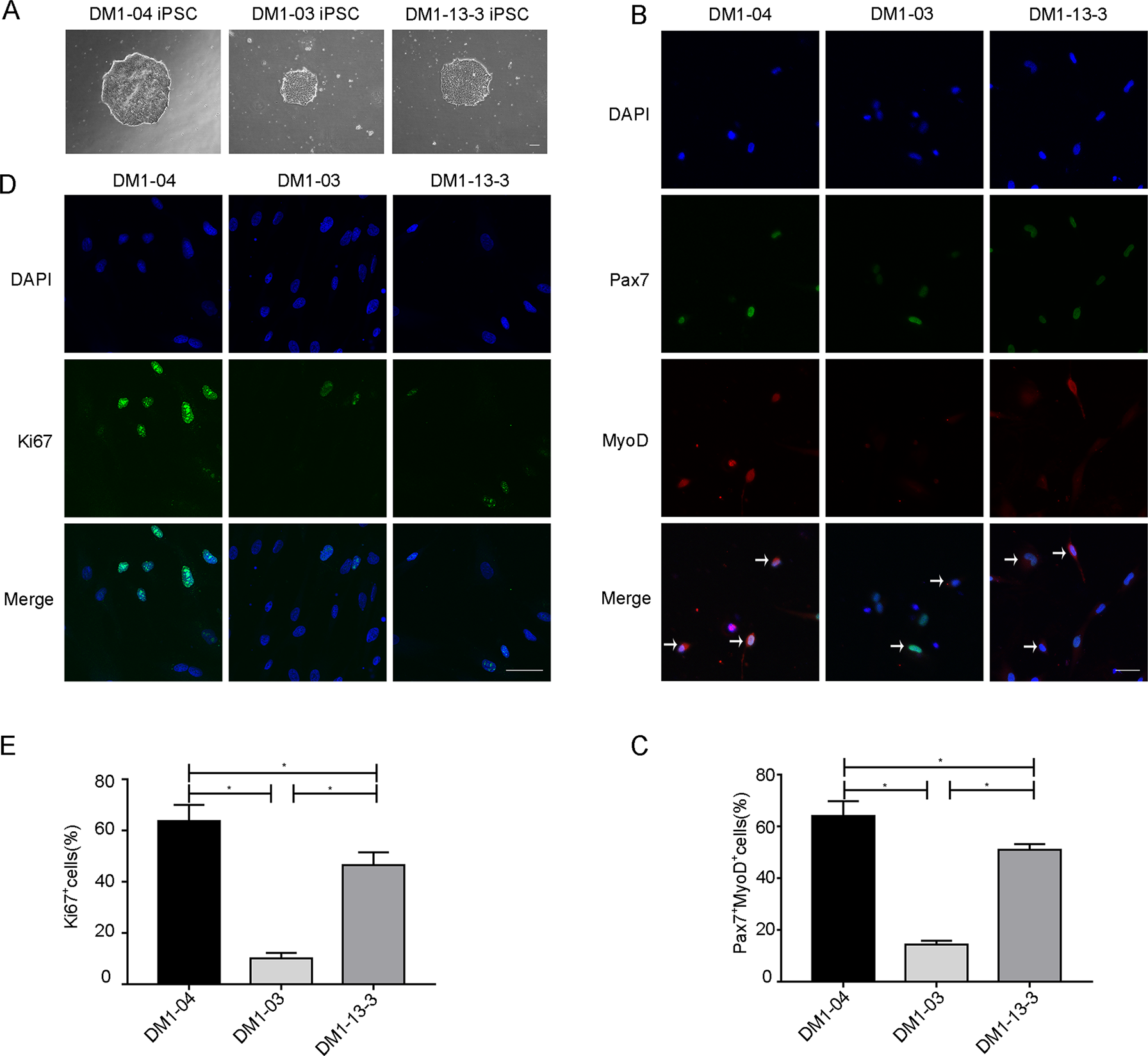 Fig. 1: The proliferative capacity of DM1 SSCs is impaired.