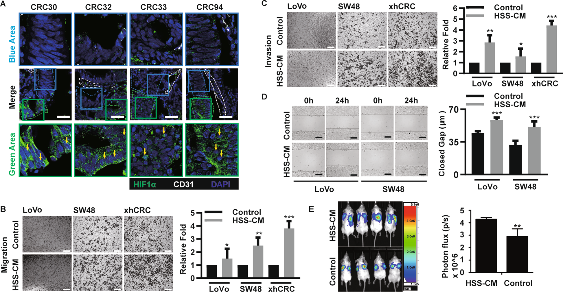 Fig. 2: Hypoxic CRC cells enhance the migration, invasion and metastatic capacity of normoxic CRC cells.