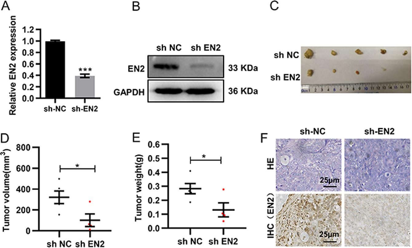 Fig. 3: EN2 knockdown restrains tumor growth in vivo.