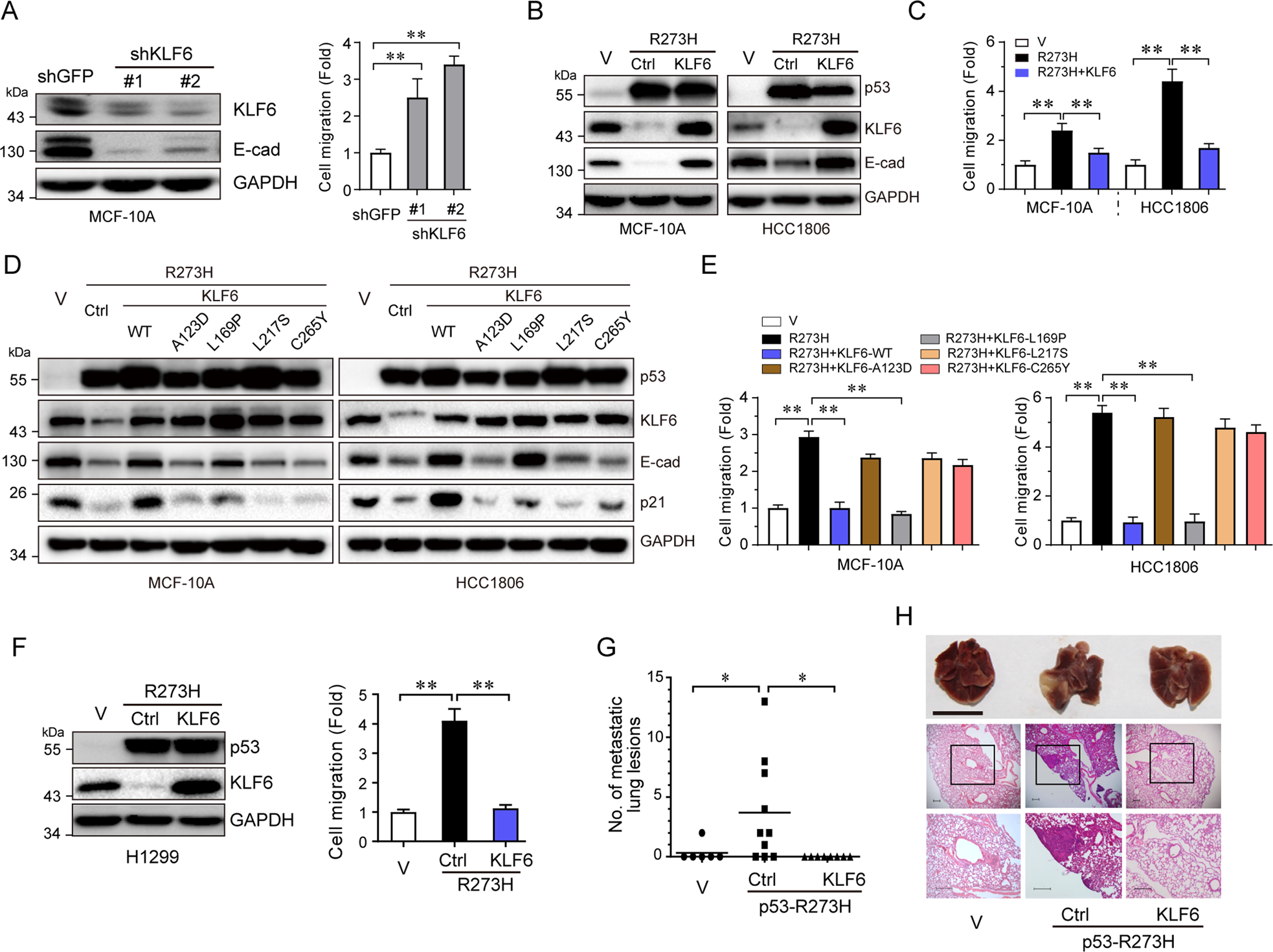 Fig. 3: KLF6 suppresses p53-R273H-induced cell migration and tumor metastasis.