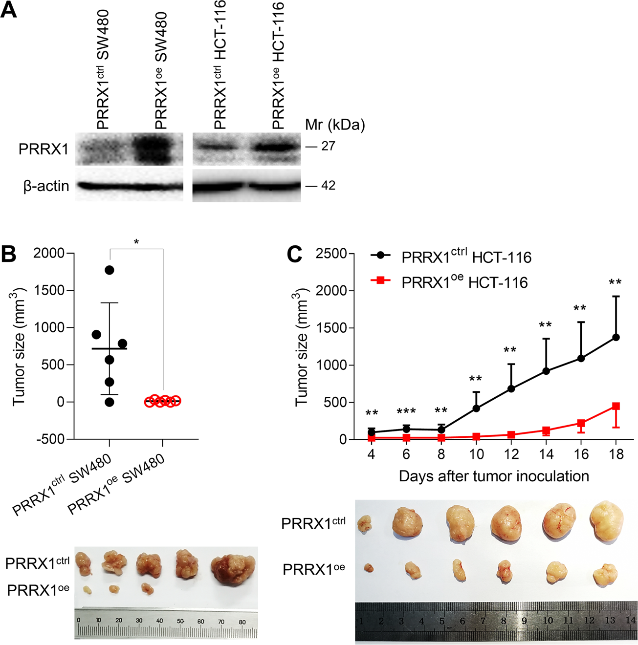 Fig. 7: The effect of PRRX1 on the growth of CRC tumors.