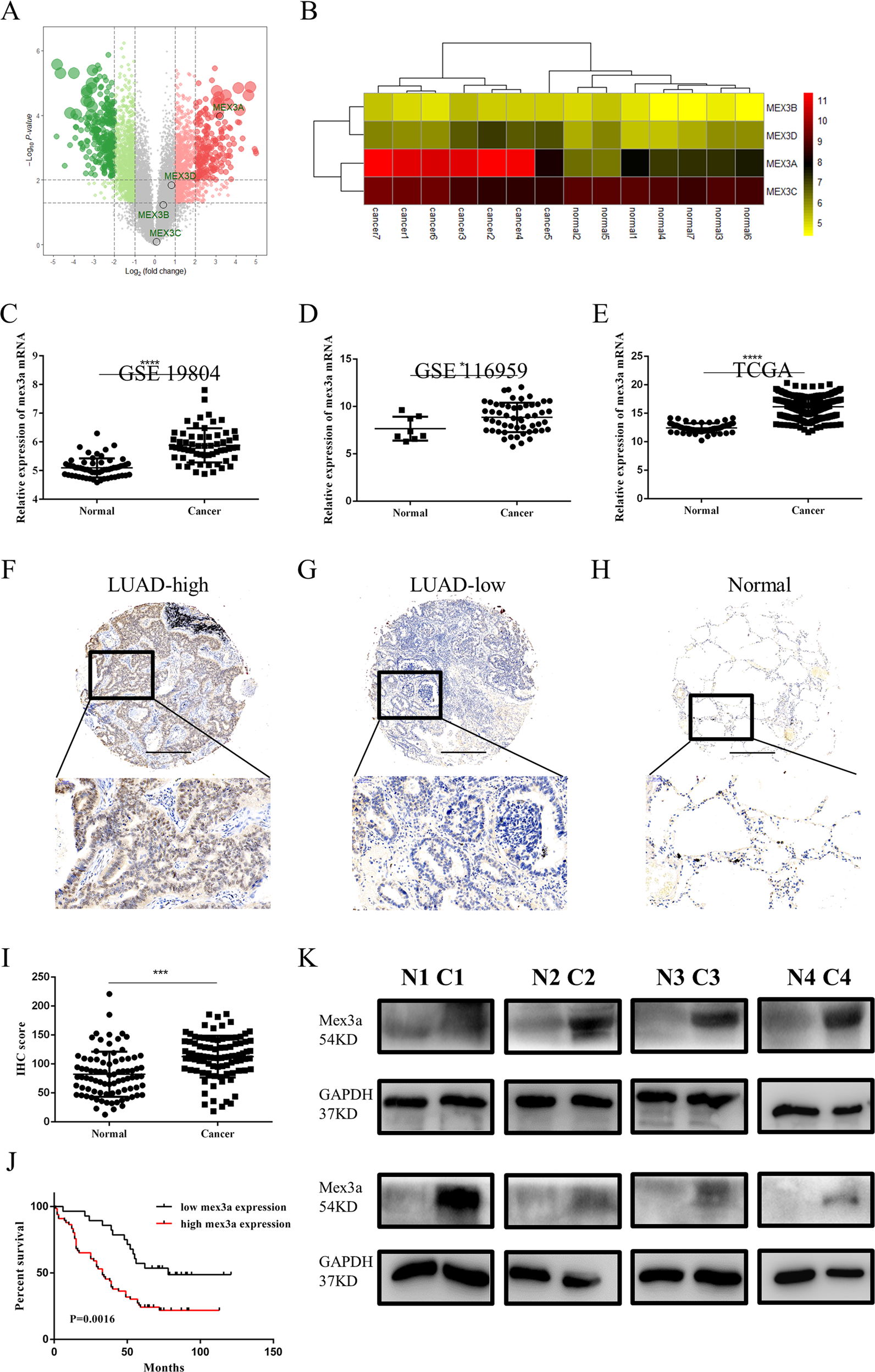 Fig. 1: Expression and prognostic significance of mex3a in LUAD.