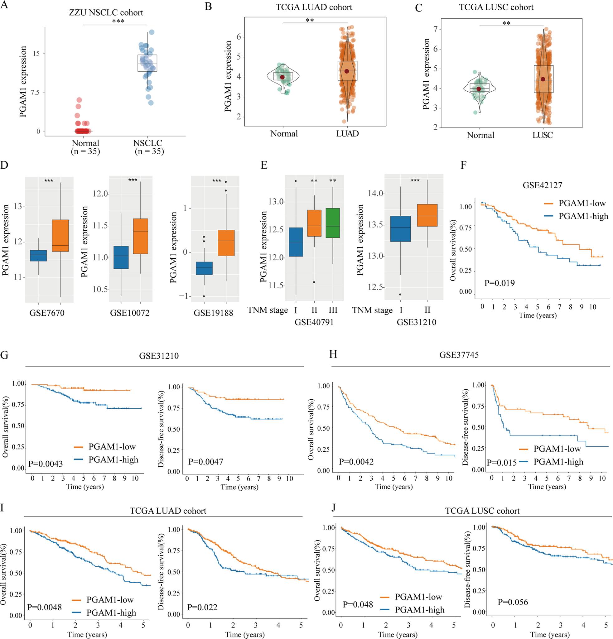 Fig. 1: PGAM1 mRNA is upregulated in NSCLC based on TCGA analysis.