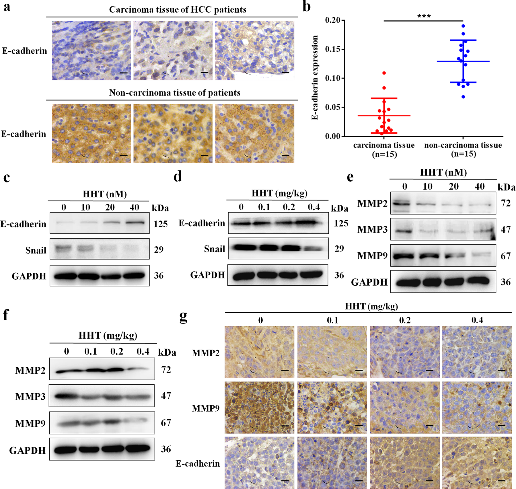 Fig. 7: E-cadherin was overexpressed in HCC patients and HHT regulates EMT-related molecules.