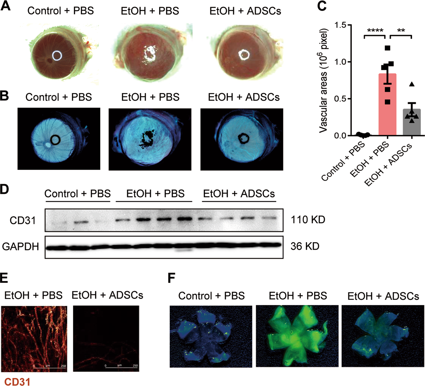 Adipose-derived mesenchymal stromal cells promote corneal wound healing by  accelerating the clearance of neutrophils in cornea | Cell Death & Disease