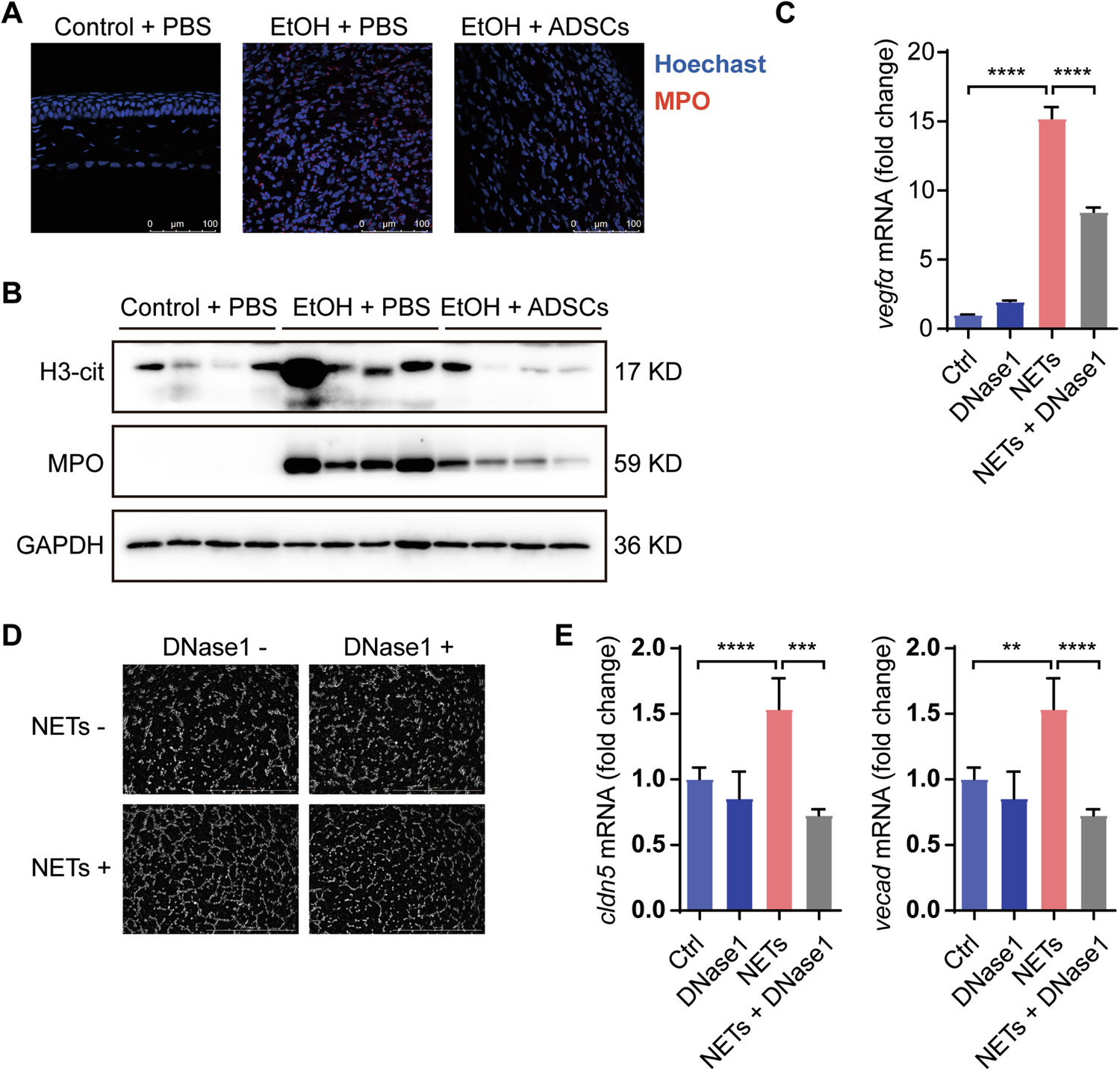 Fig. 7: Neutrophil extracellulartraps (NETs) promote corneal neovascularization.