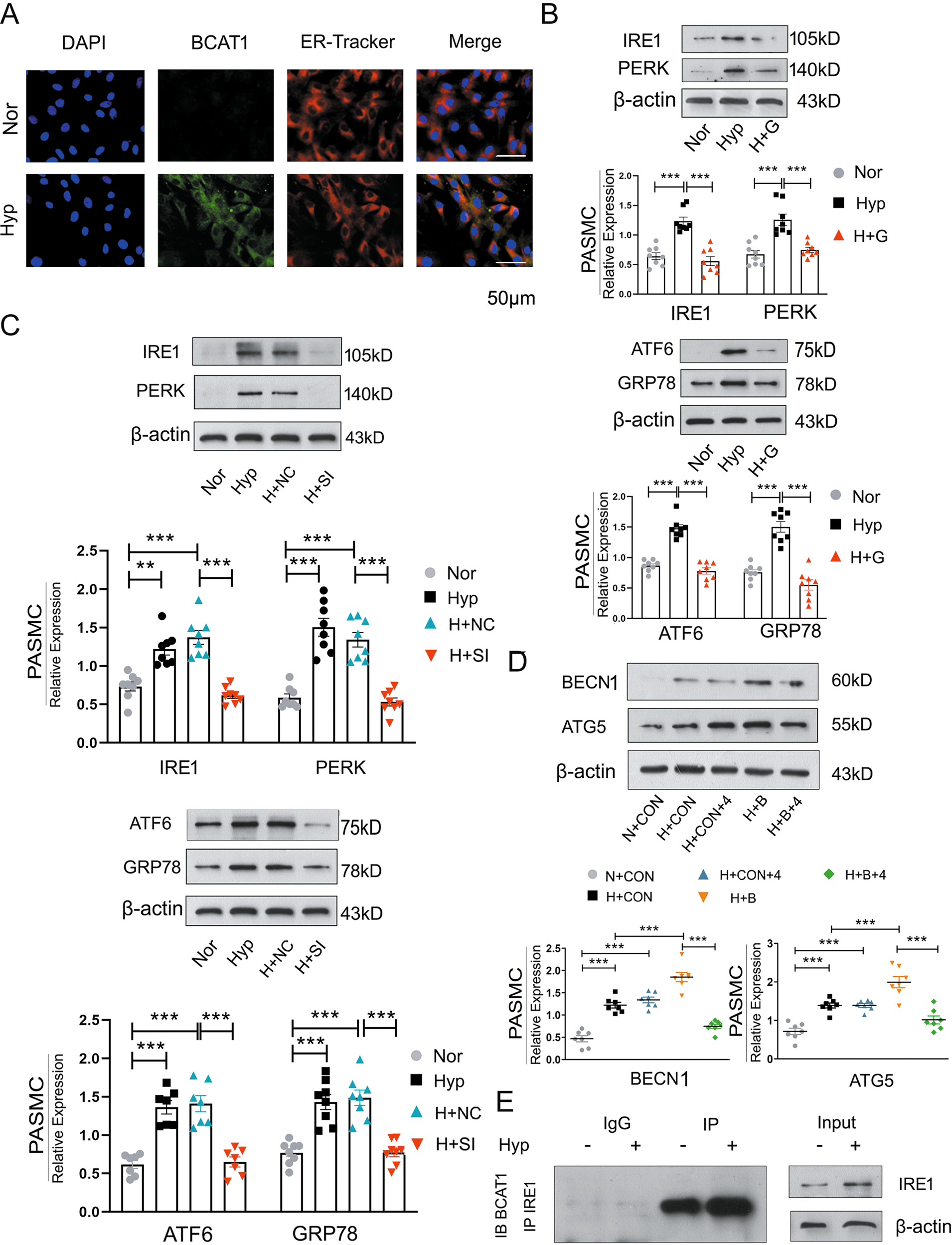 Fig. 3: BCAT1 regulates autophagy through the endoplasmic reticulum stress pathway.