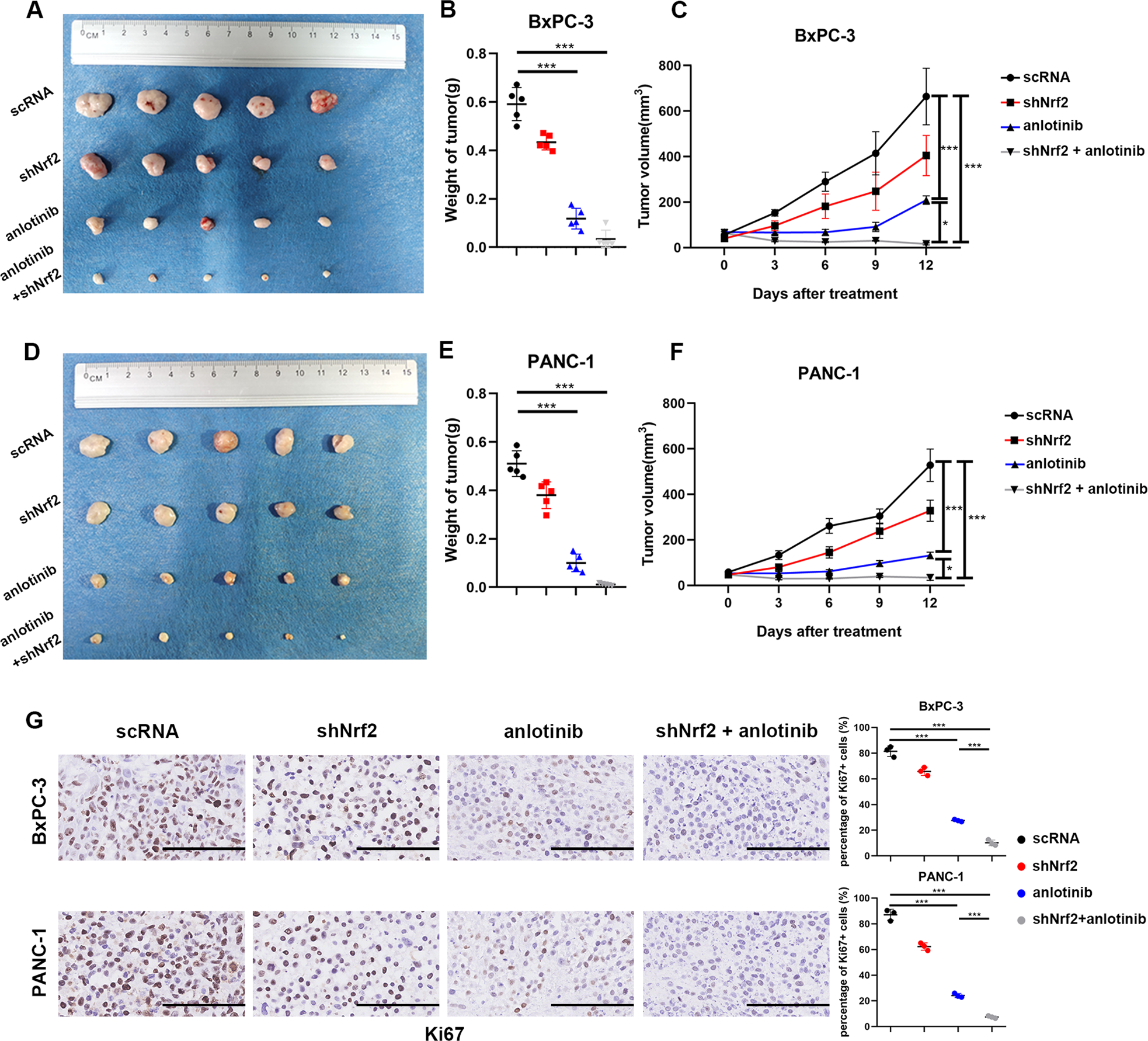 Fig. 7: Tumour suppression induced by anlotinib is enhanced by suppression of Nrf2 in vivo.
