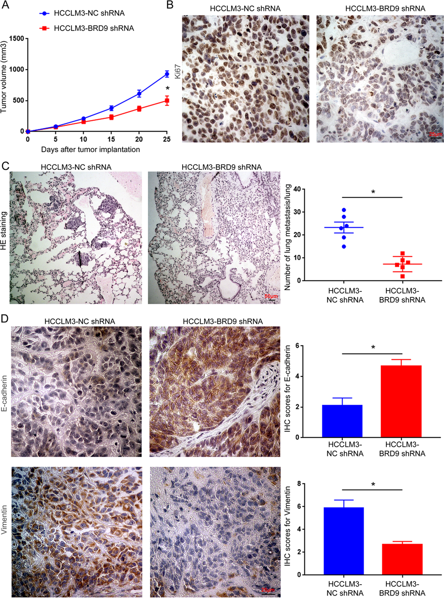 Fig. 4: BRD9 knockdown suppresses the growth and metastasis of HCC in vivo.