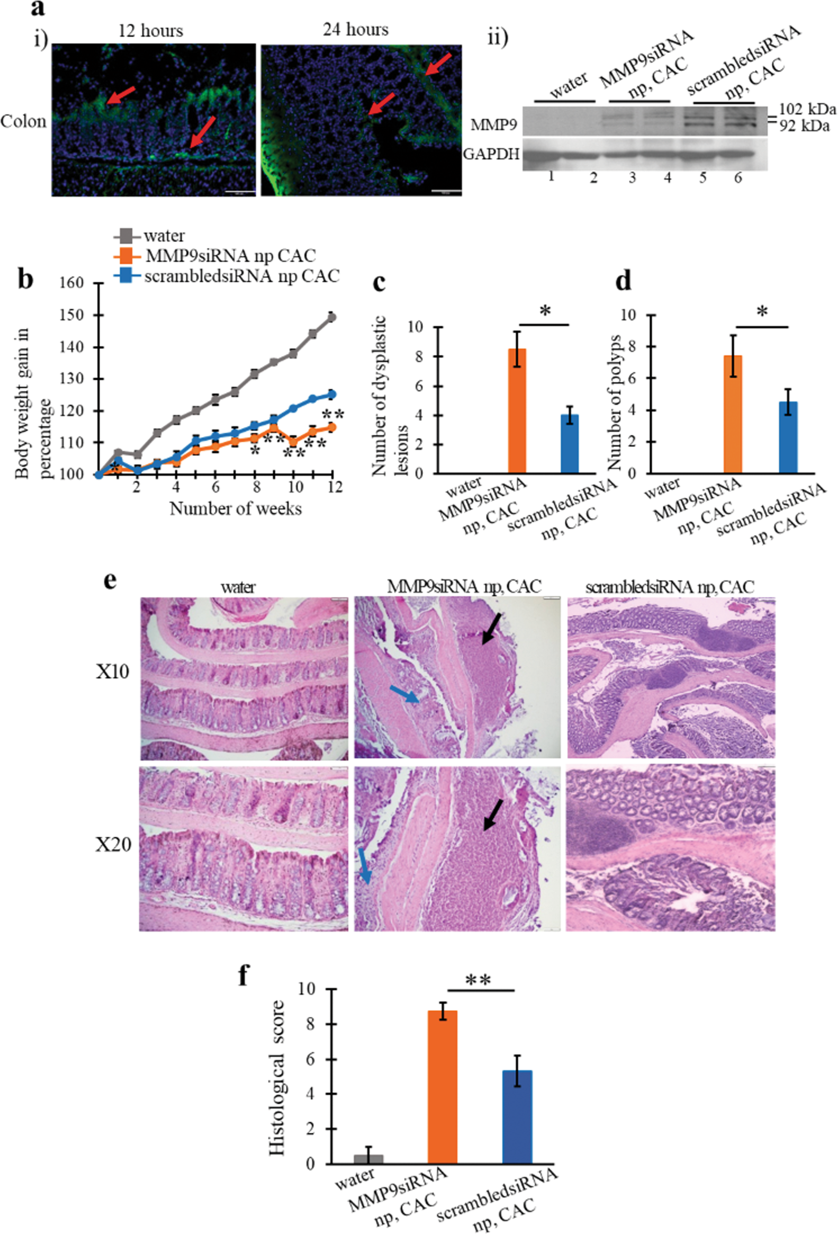 Fig. 3: Silencing of MMP9 by MMP9 siRNA loaded nanoparticles worsened CAC conditions in mice.