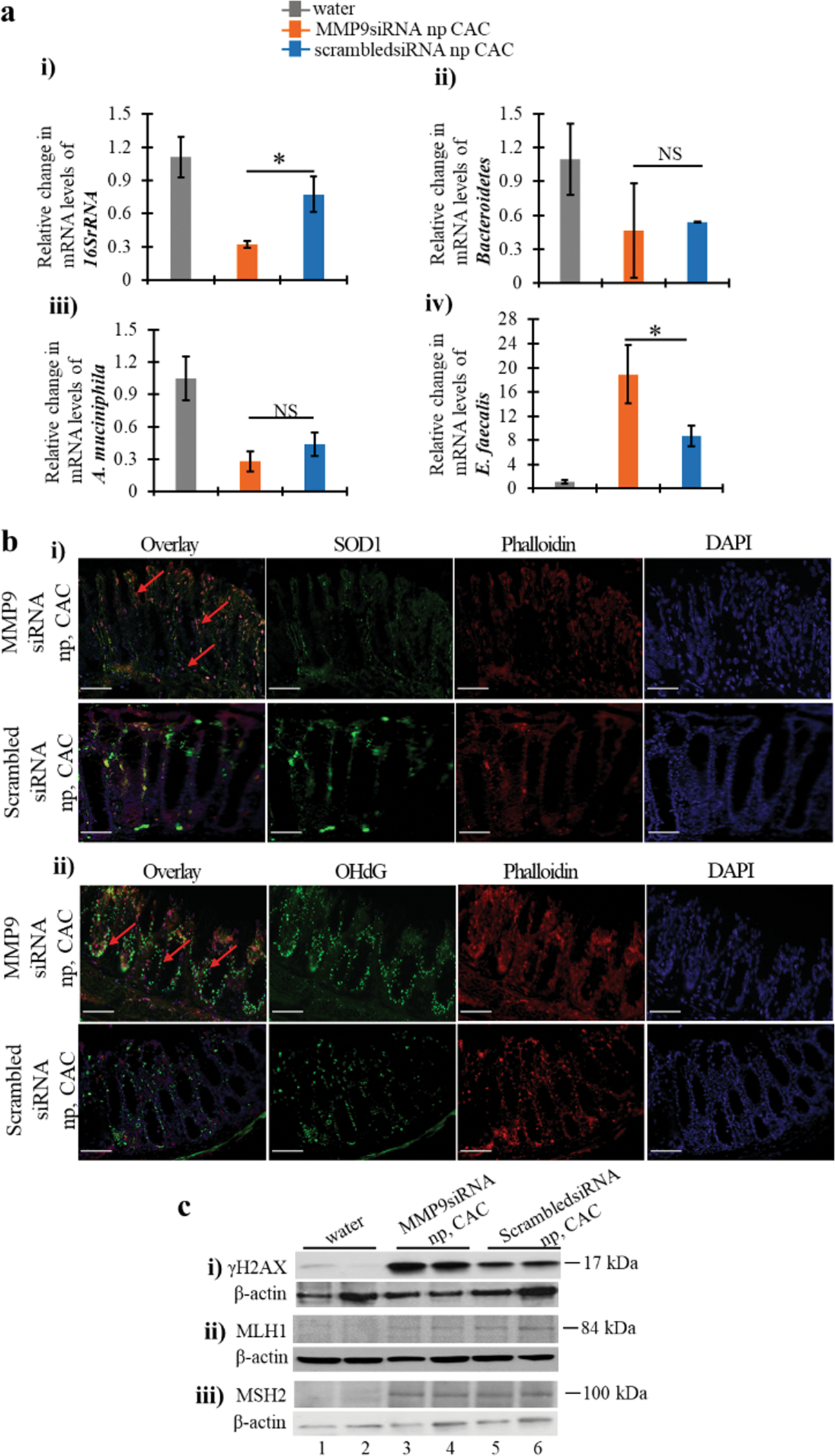 Fig. 4: Silencing of MMP9 by nanoparticles alters the microbiota and ROS levels in CAC.