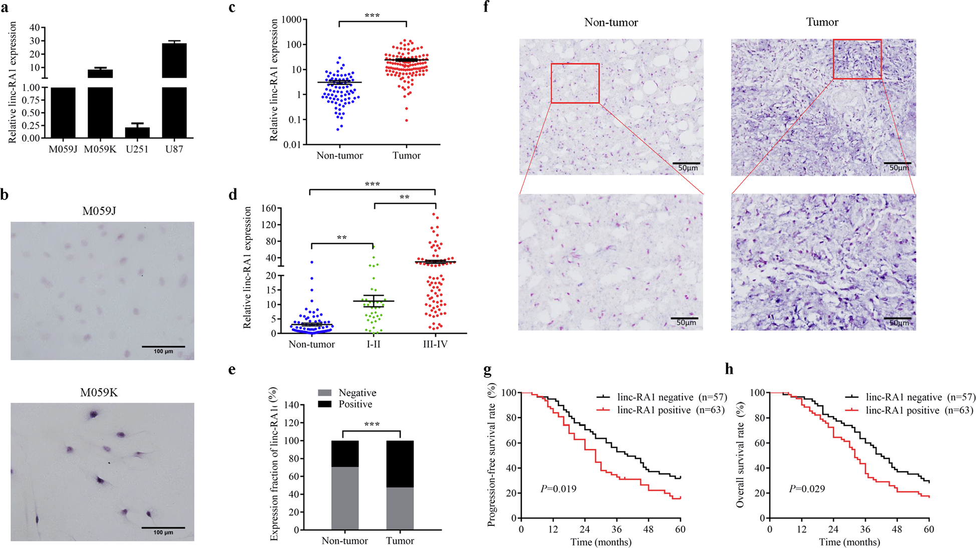 Linc-RA1 inhibits autophagy and promotes radioresistance by preventing  H2Bub1/USP44 combination in glioma cells | Cell Death & Disease