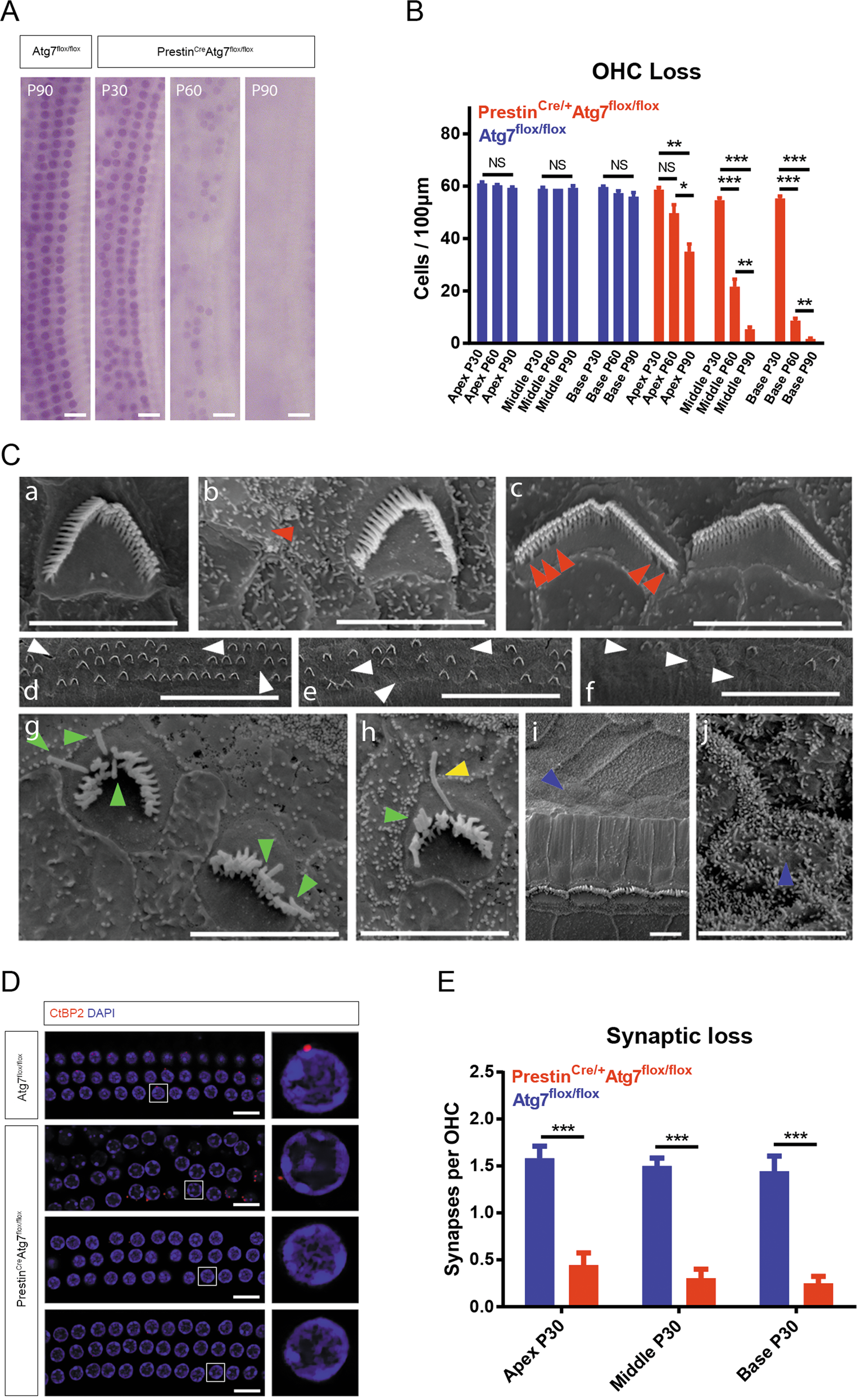 Fig. 3: Morphological changes in PrestinCre/+Atg7flox/flox mice and controls.