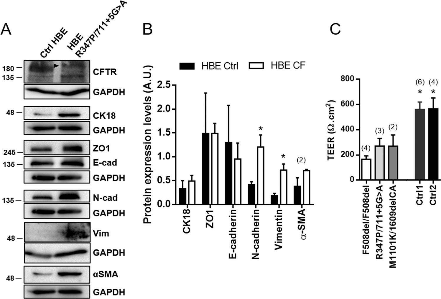 Fig. 2: Primary CF HBE cells show increased expression levels of mesenchymal markers and impaired TEER.