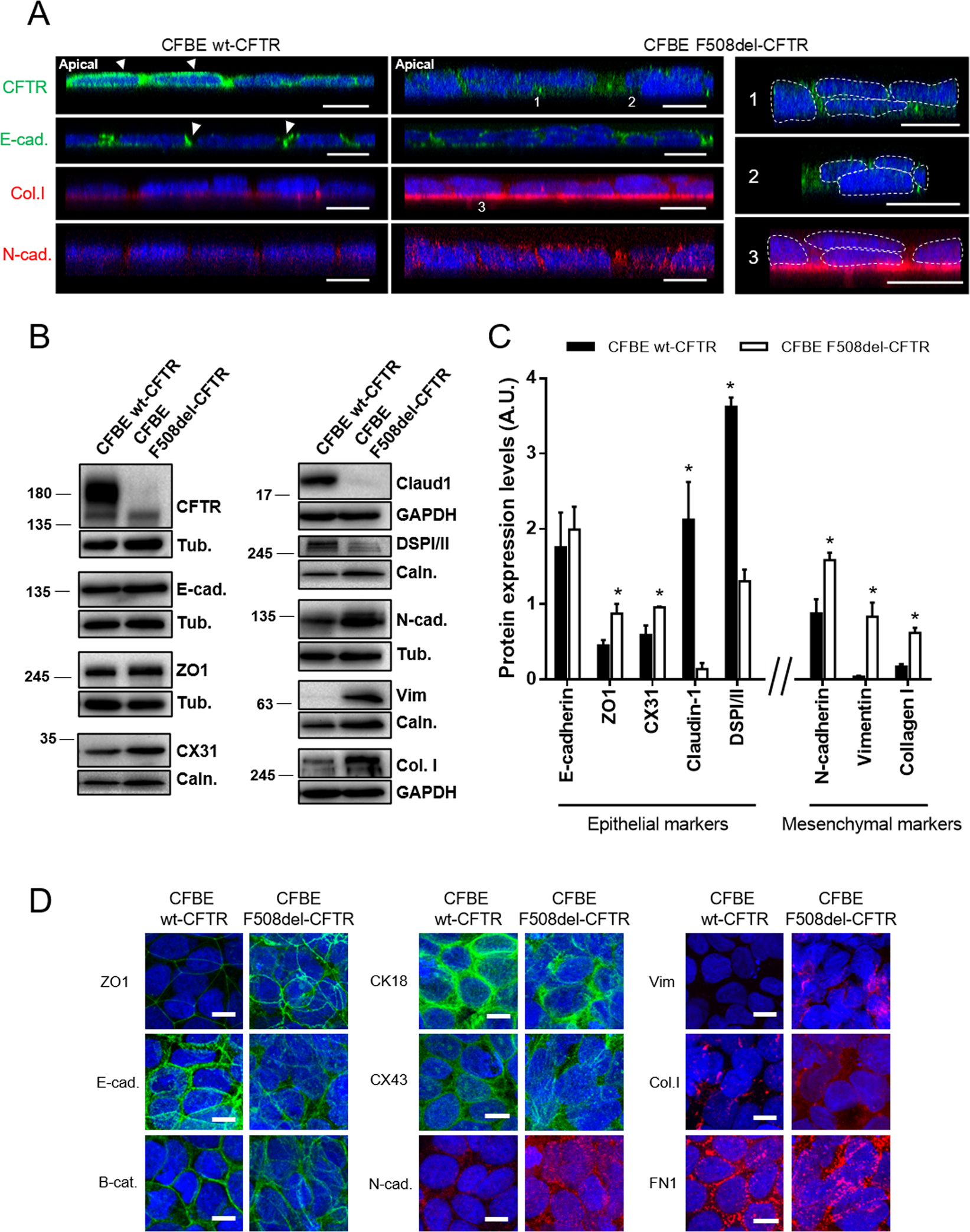 Fig. 3: Polarized F508del-CFTR CFBE cells show mislocalized/disorganized epithelial markers and increased mesenchymal markers.