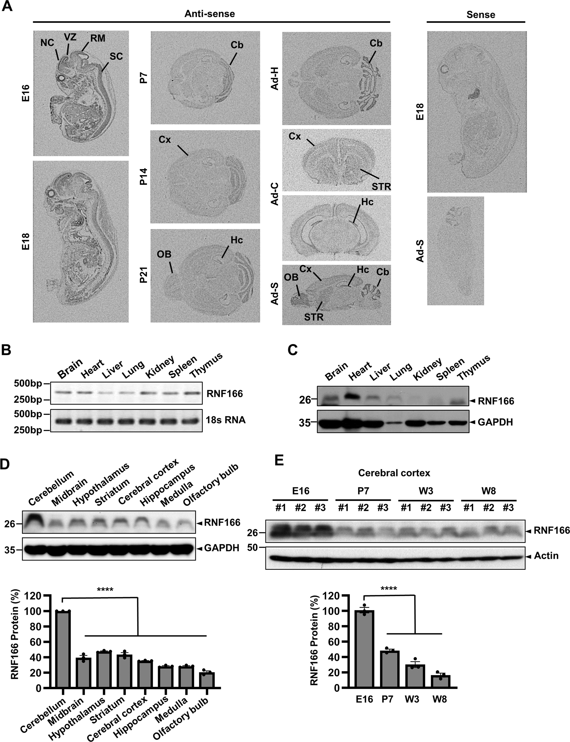 Fig. 1: Temporal and spatial expression pattern of RNF166 mRNA and protein in various tissues.