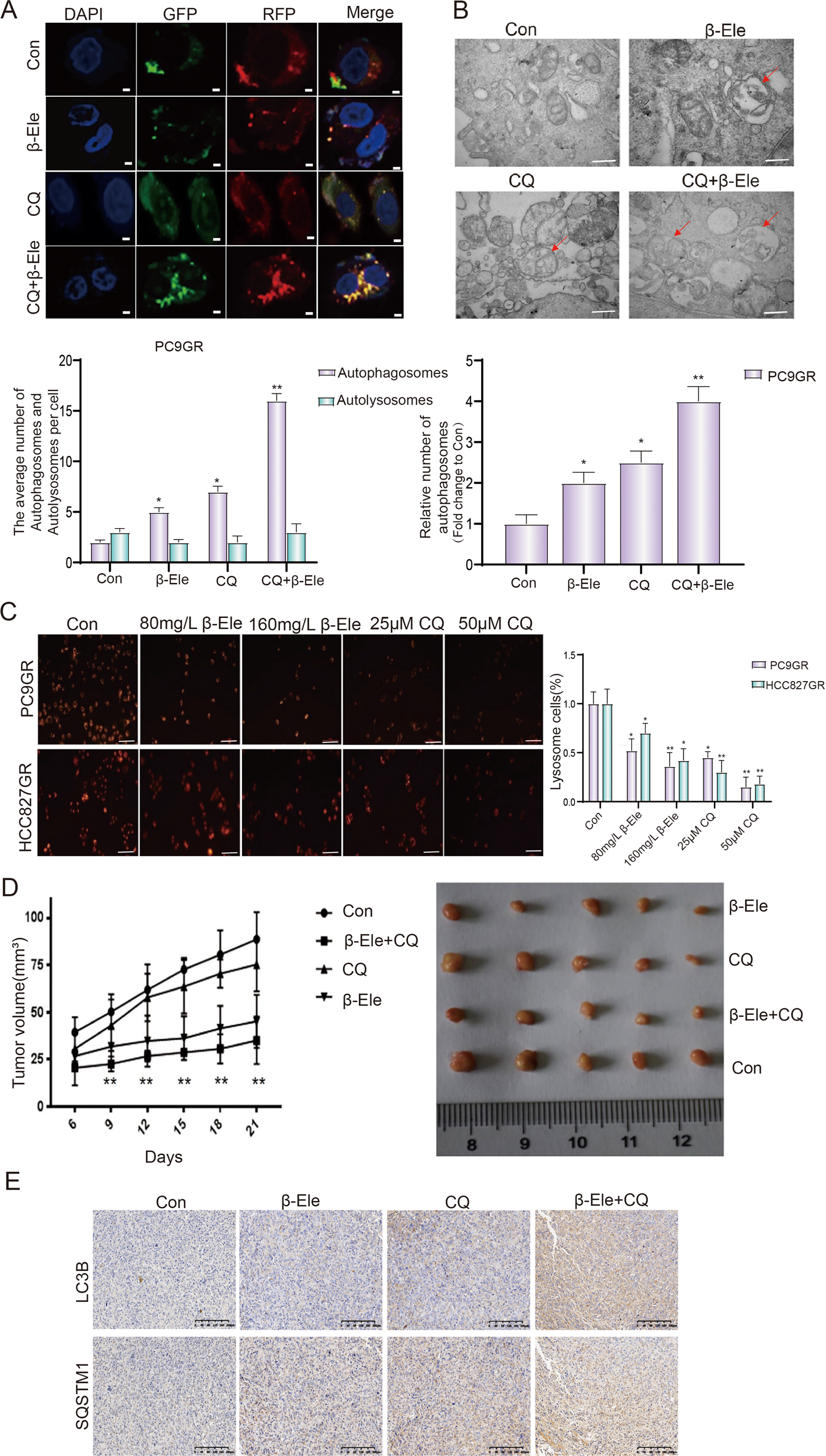 Fig. 4: β-elemene blocked autophagy flux in NSCLC cells.