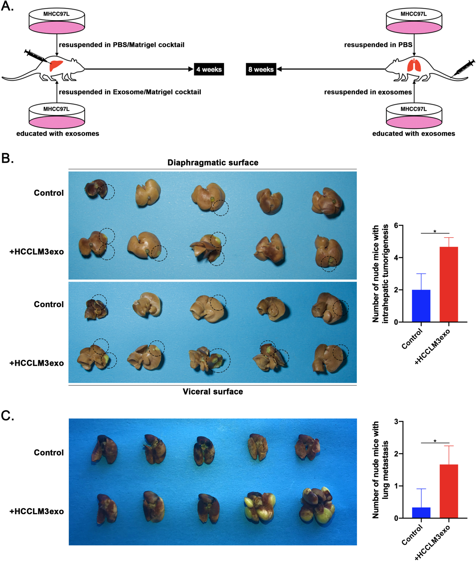 Fig. 2: HCCLM3exos promote the growth and metastasis of MHCC97L cells in vivo.