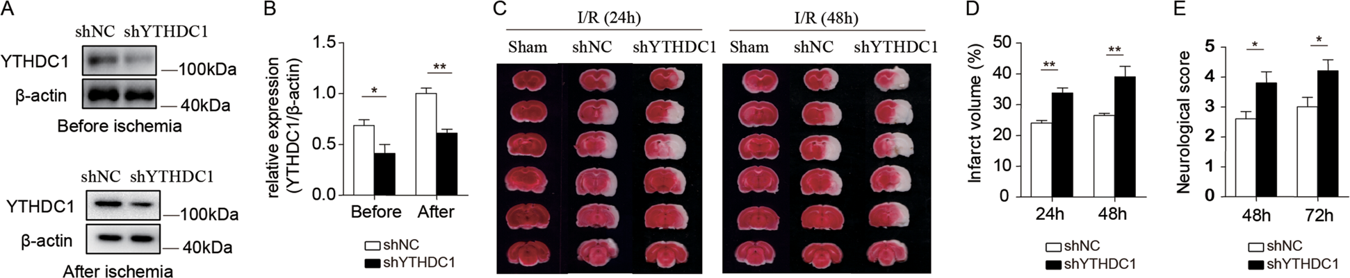 Fig. 2: Knockdown of YTHDC1 exacerbates ischemic brain injury.
