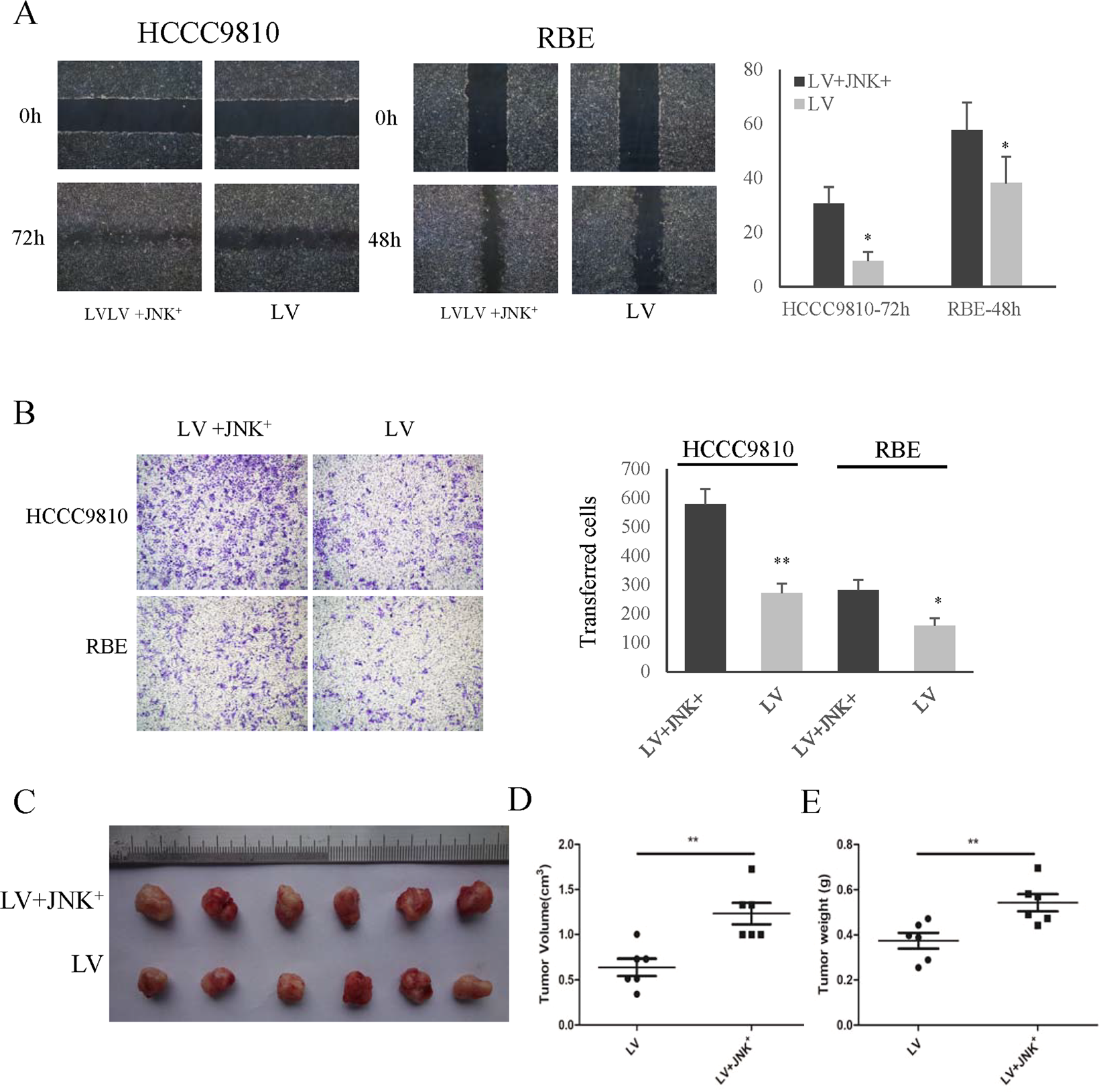 Fig. 6: BUB1B regulated invasiveness of CAA cells in a JNK-c-Jun-dependent manner.