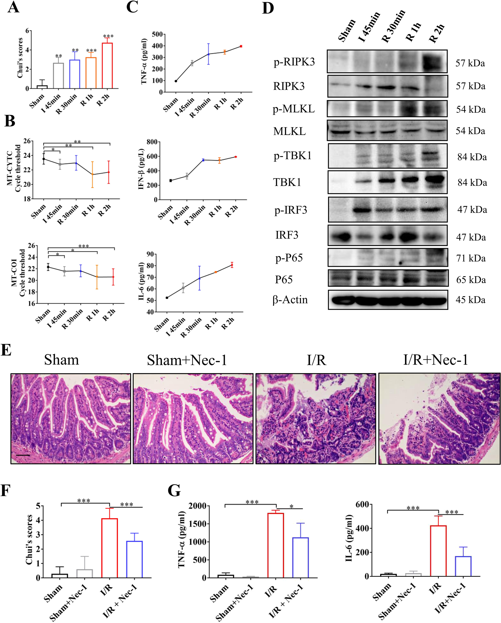 Fig. 4: Necroptosis promotes gut barrier dysfunction following intestinal ischemia reperfusion.