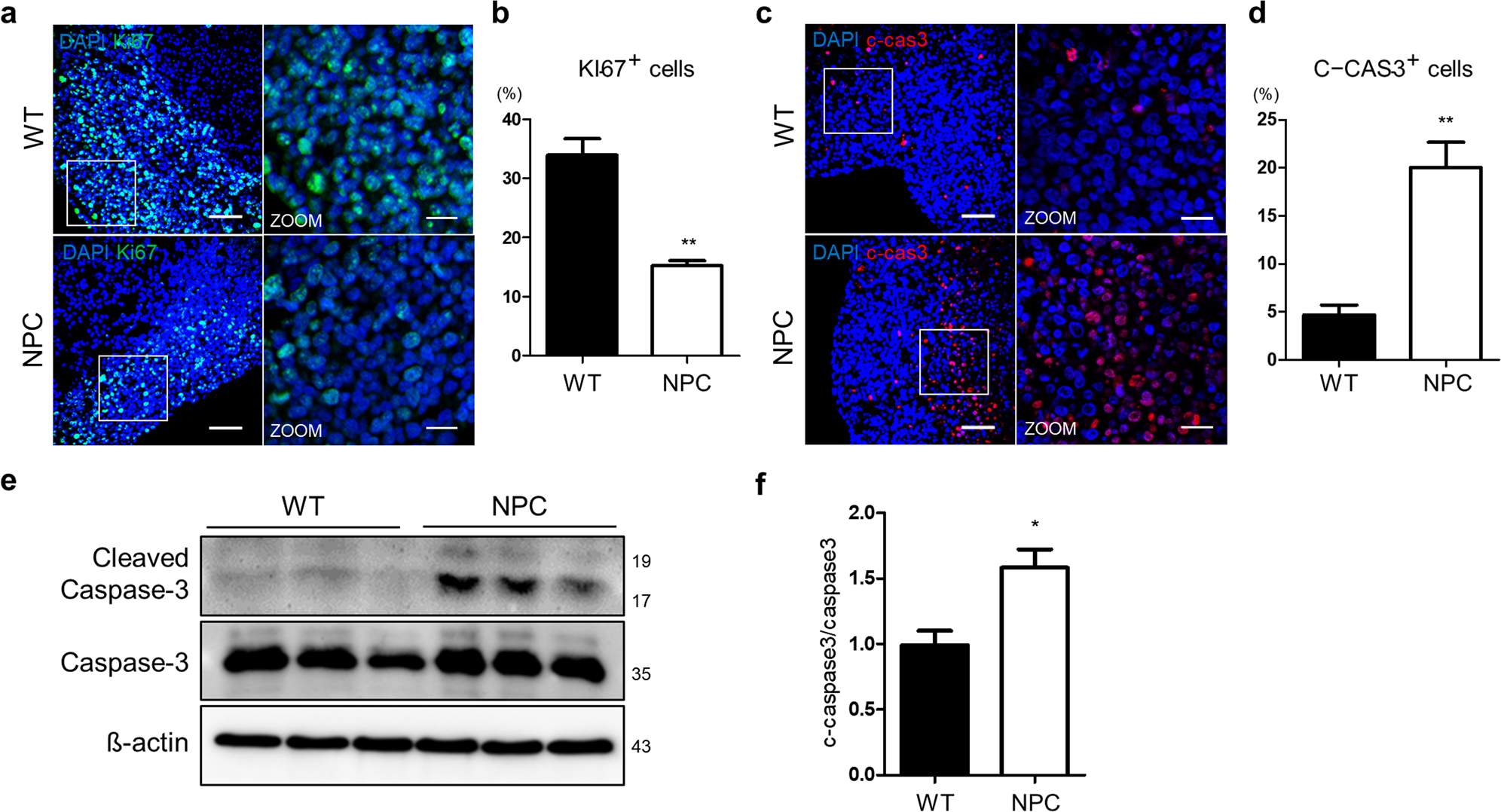 Fig. 3: NPC organoids showed decreased proliferation.
