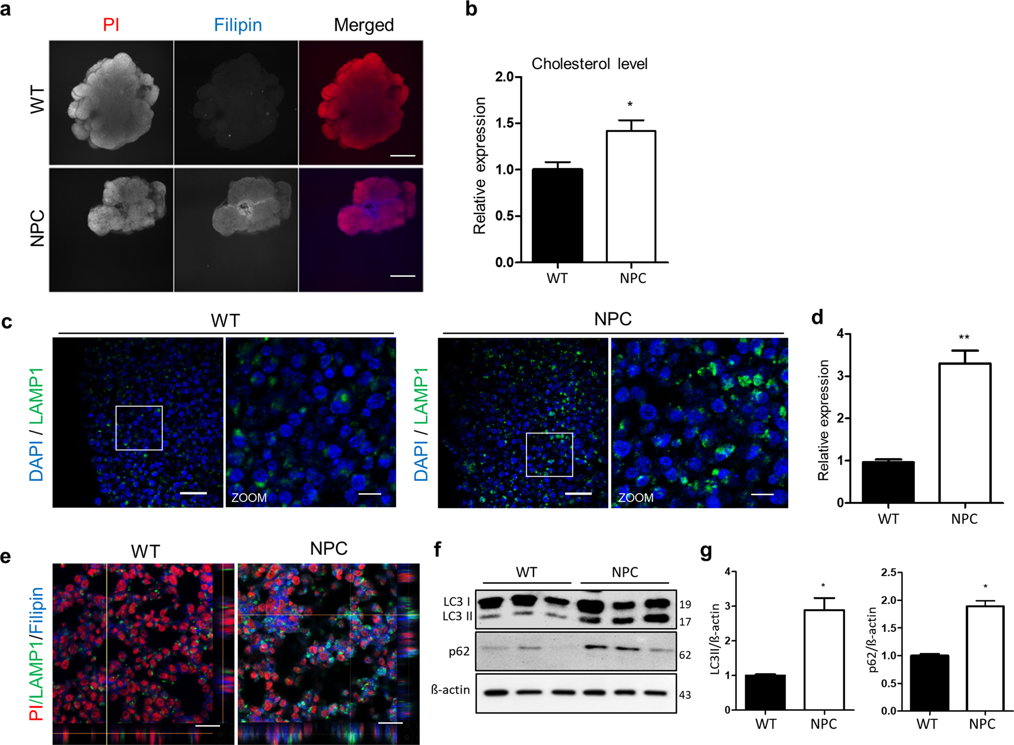 Fig. 4: Cholesterol accumulation in NPC organoids.