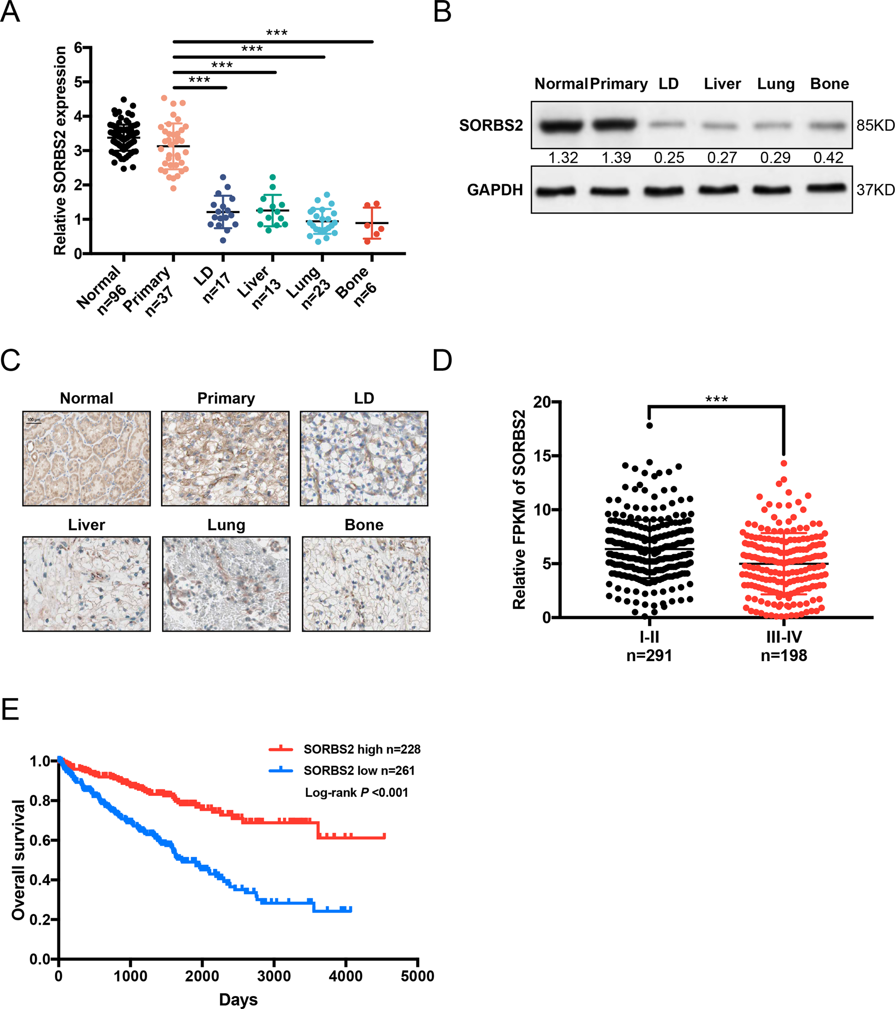 Fig. 1: SORBS2 downregulation in ccRCC tissues and its association with poor prognosis.