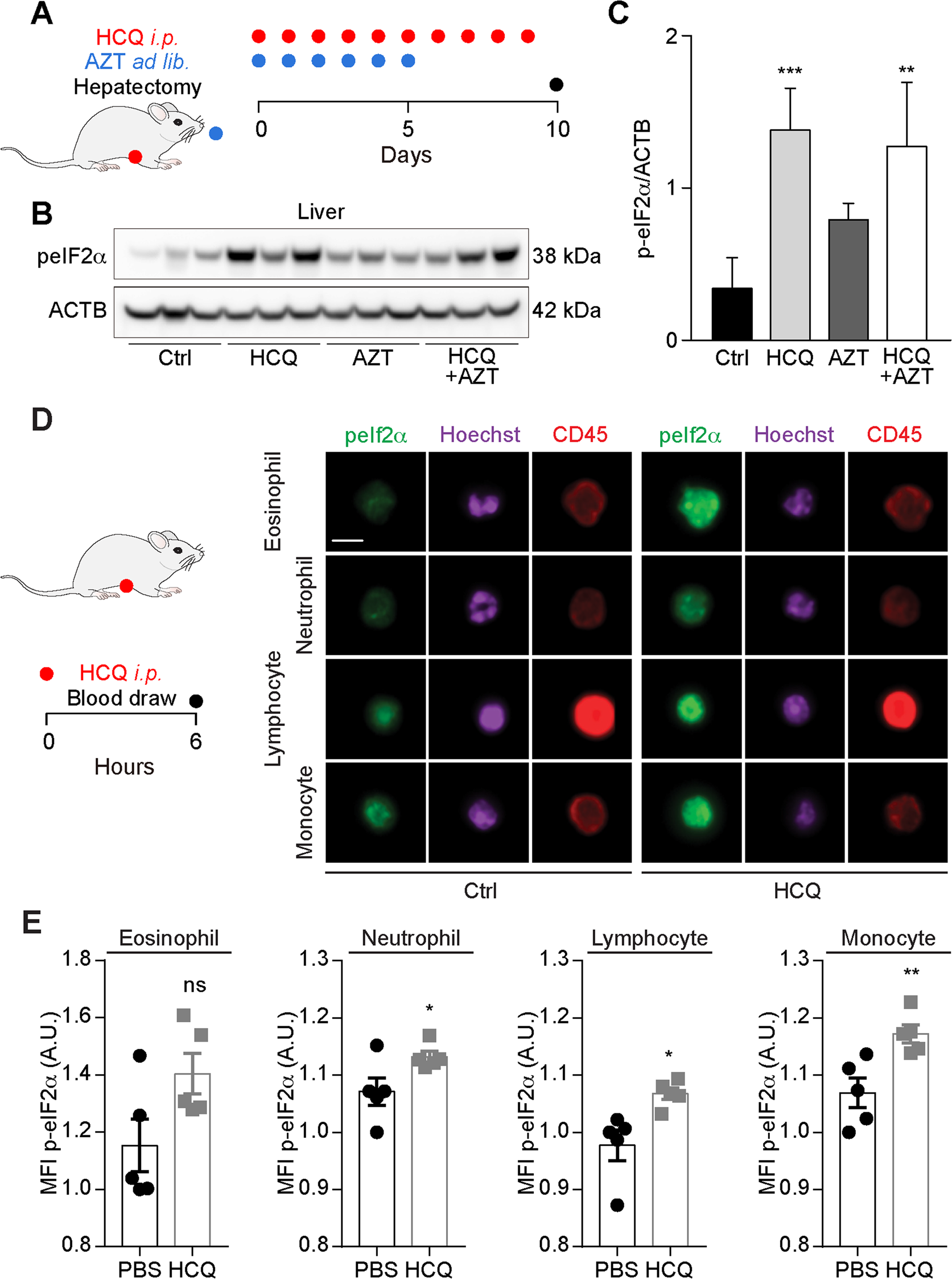 Fig. 6: Effects of hydroxychloroquine plus azithromycin in vivo.