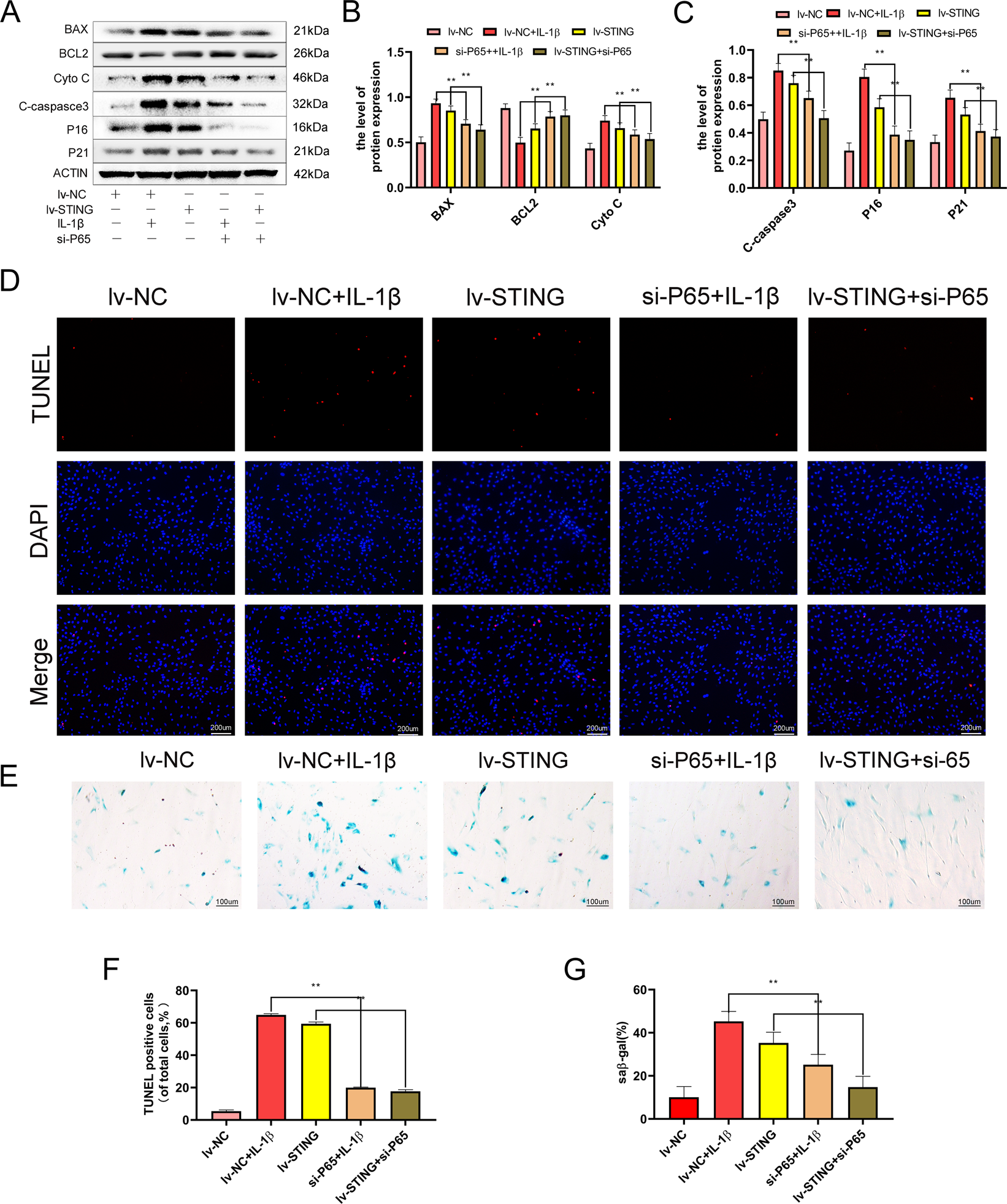 Fig. 5: STING induces chondrocyte senescence and apoptosis via NF-κB activation.