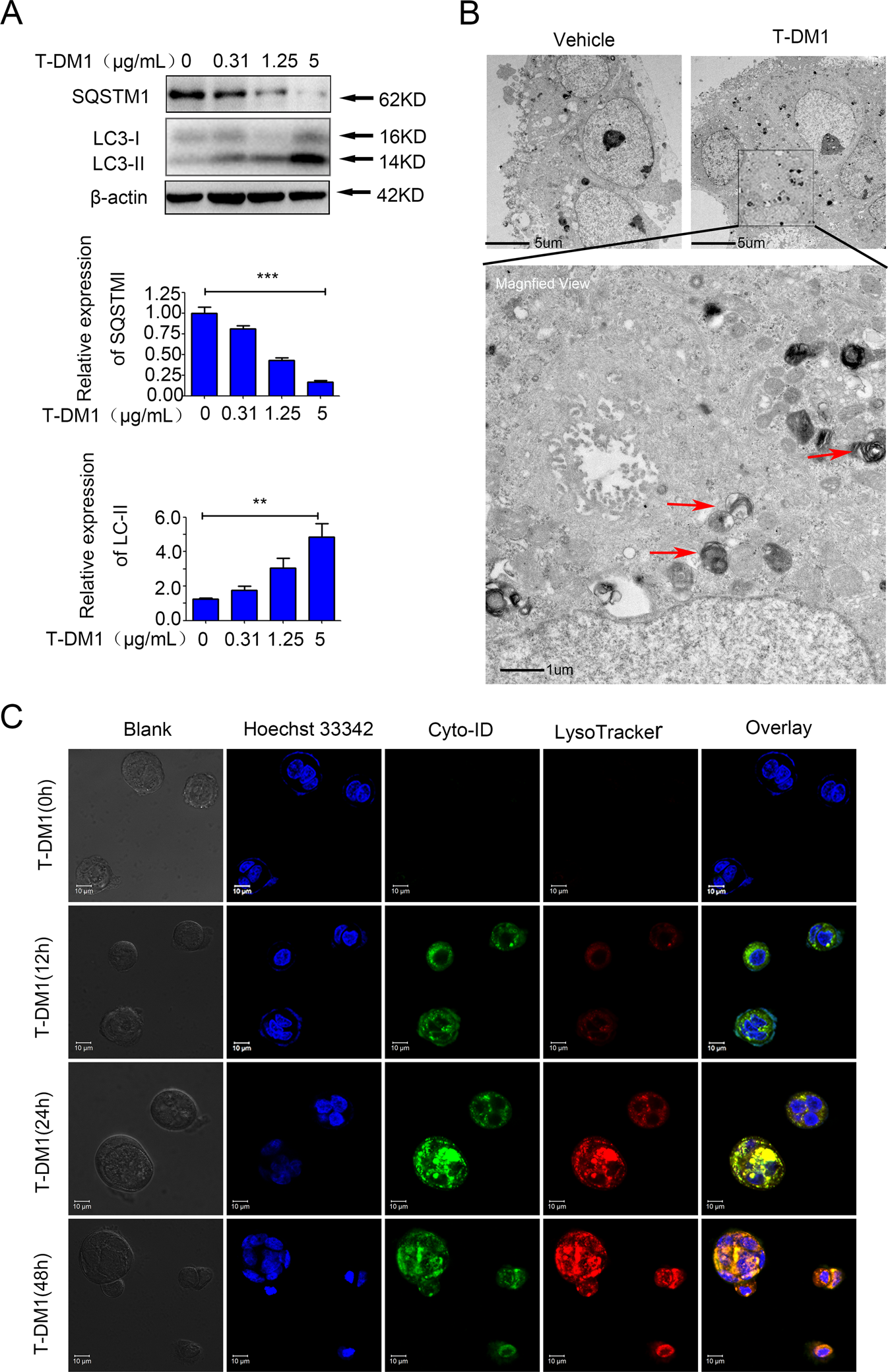 Fig. 3: Autophagosomes were induced in HER2-positive GC cells by T-DM1 treatment.