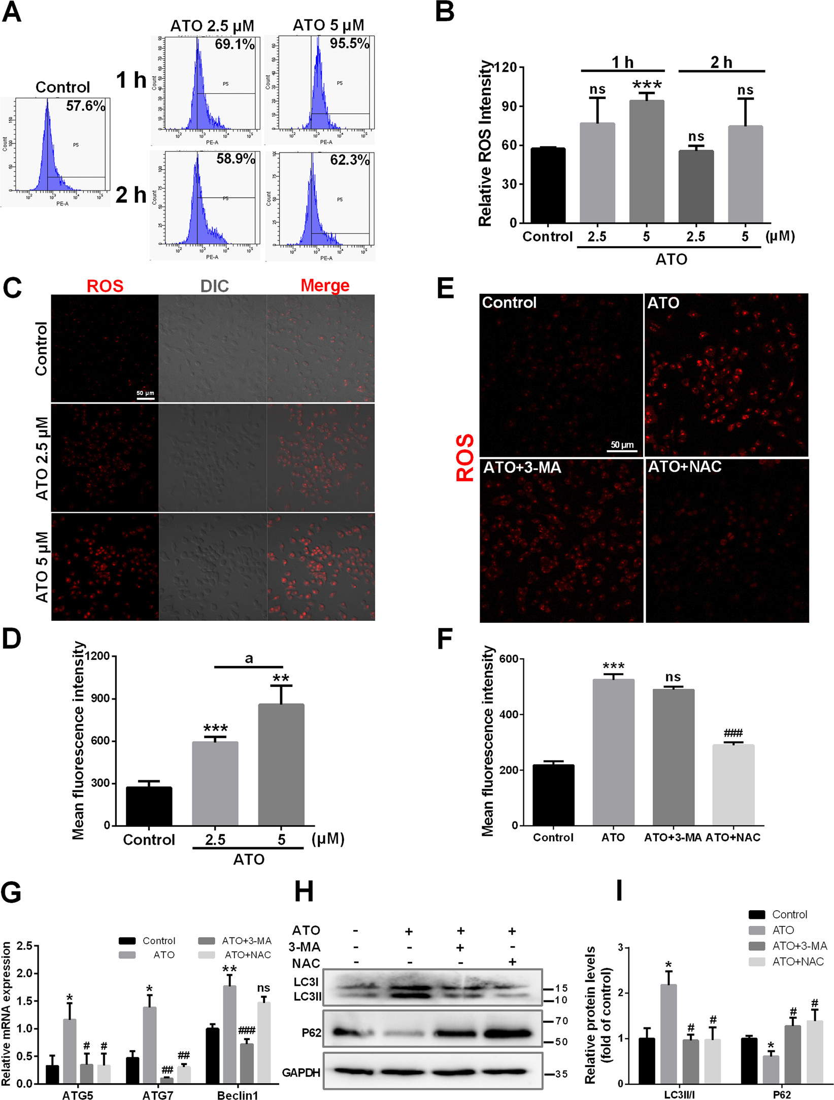 Fig. 3: ROS contribute to ATO-induced autophagy in macrophages.