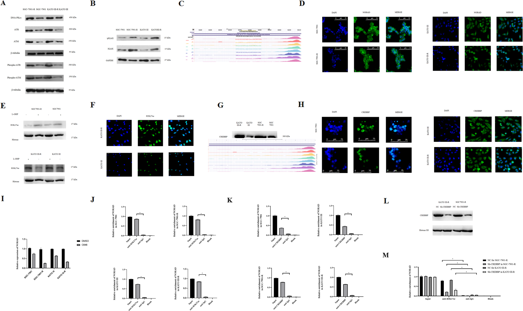 Fig. 4: NORAD was associated with DNA damage repiar response and induced by H3K27ac.