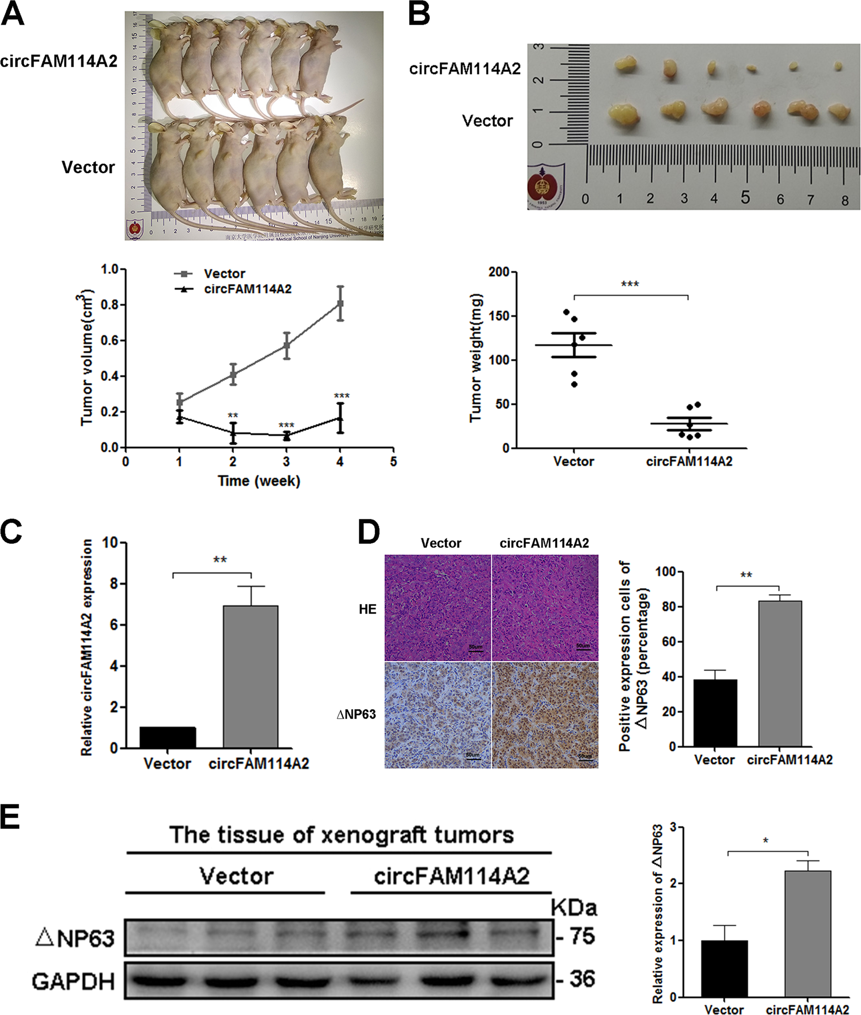 Fig. 7: Overexpression of circFAM114A2 could inhibit the growth of UCB cells in vivo.