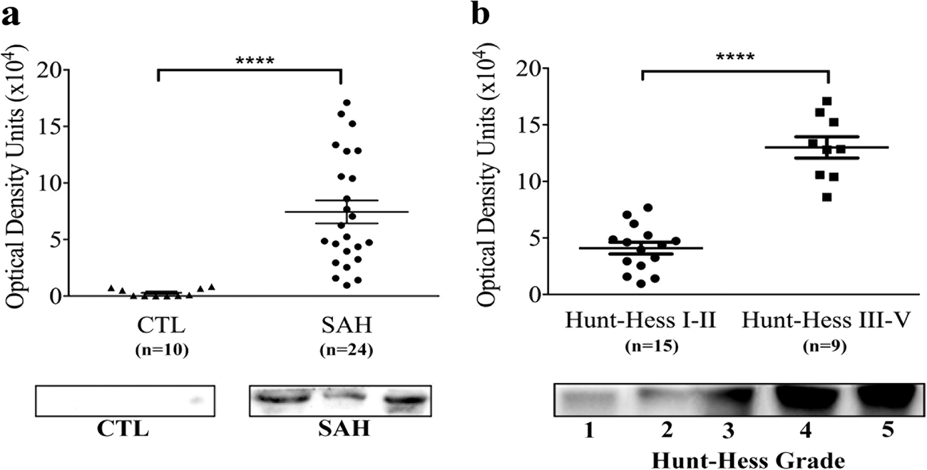 Fig. 1: AIM2 levels were measured in CSF from patients.