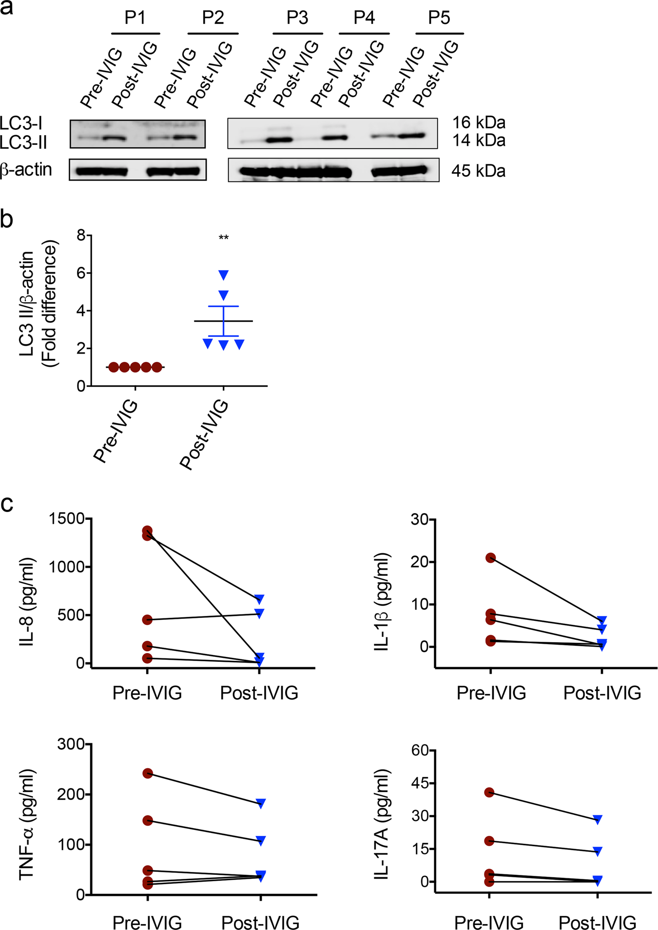 Fig. 8: IVIG therapy in inflammatory myopathy patients induces autophagy.