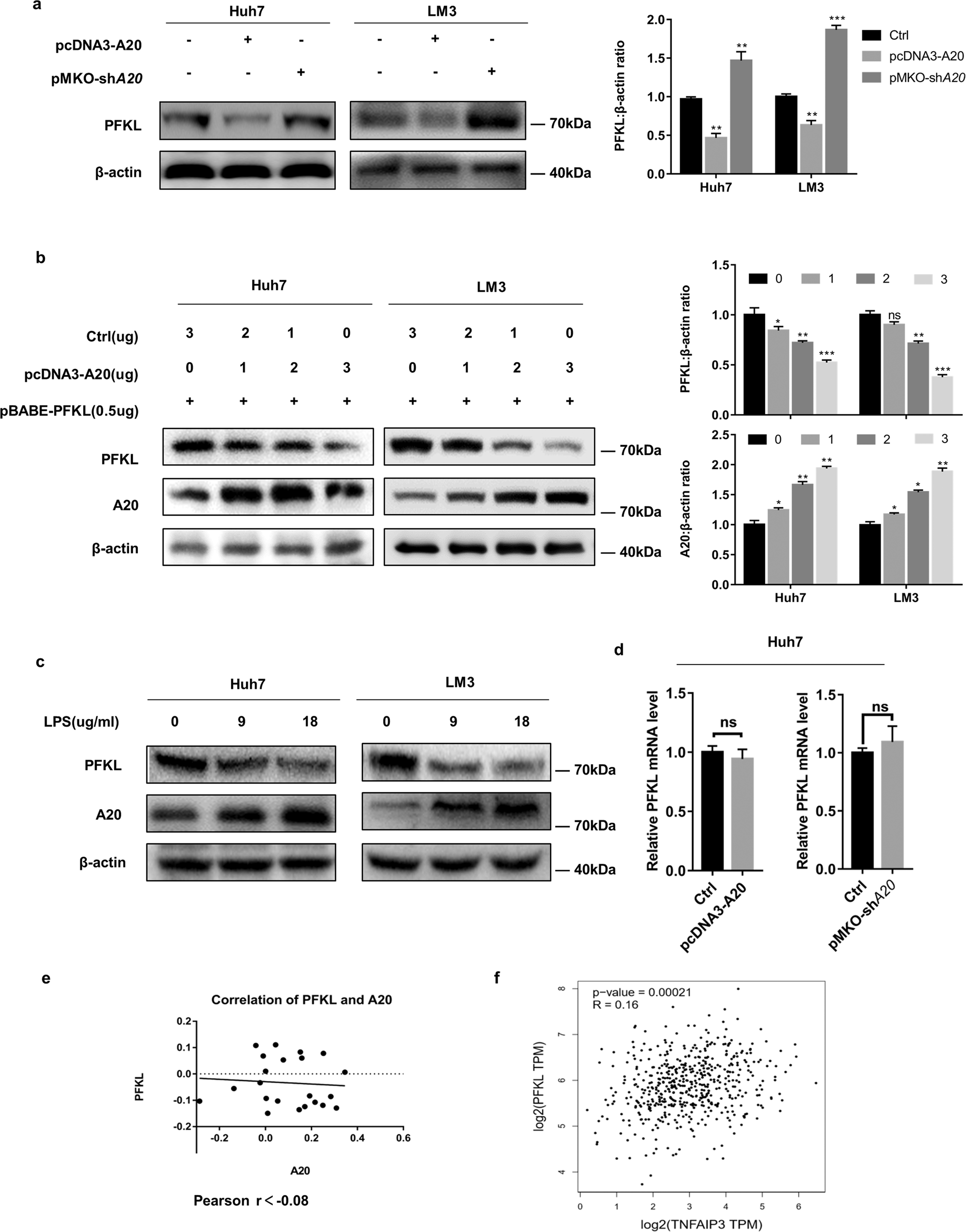 Fig. 3: A20 downregulates PFKL protein levels by post-transcriptional modification.
