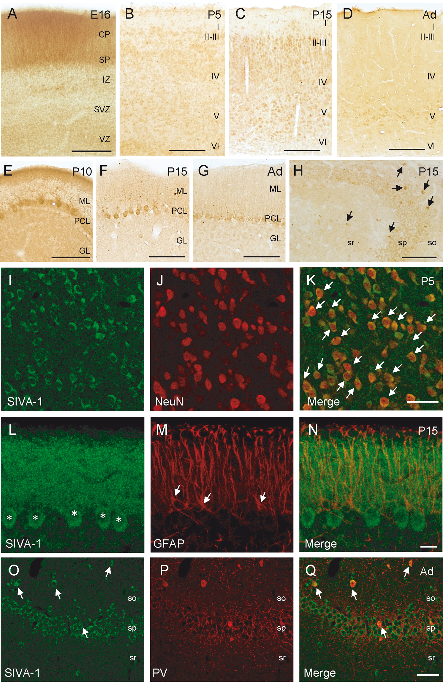 Fig. 2: SIVA-1 is expressed in neurons during the development of the mouse brain.