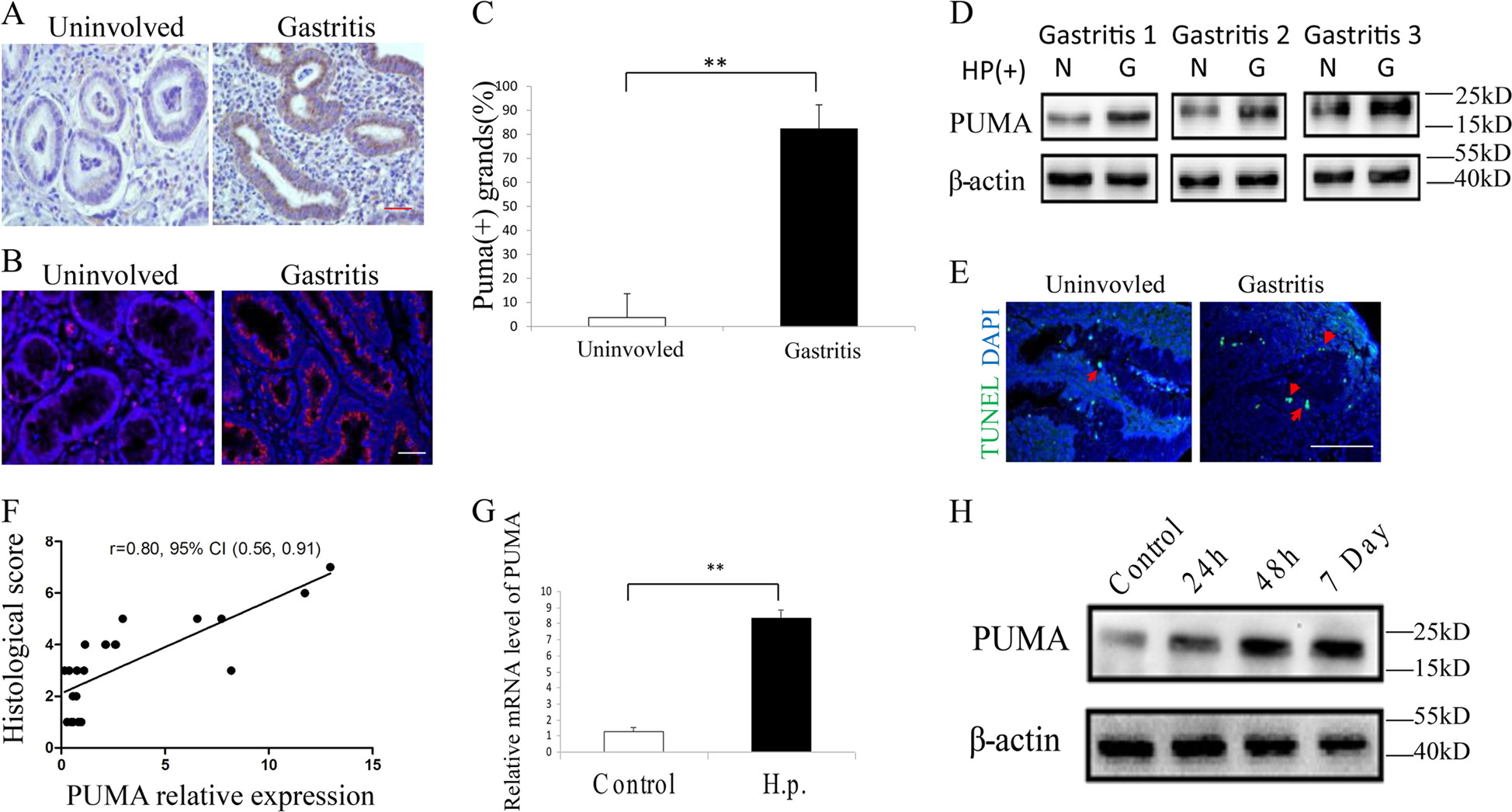 PUMA-mediated epithelial cell apoptosis promotes Helicobacter pylori  infection-mediated gastritis | Cell Death & Disease