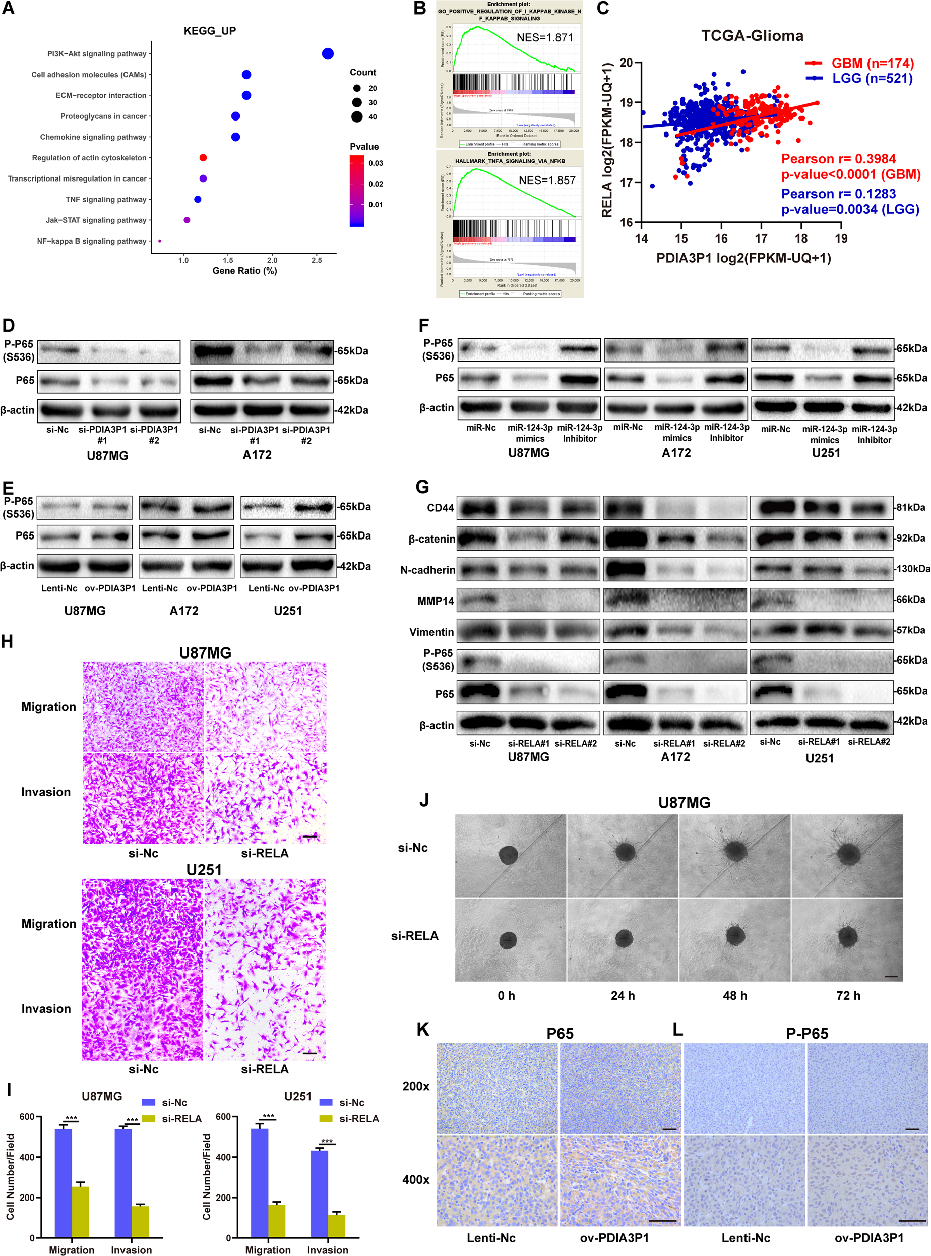 Fig. 5: PDIA3P1 induced glioma MES transition by activating the NF-κB pathway.