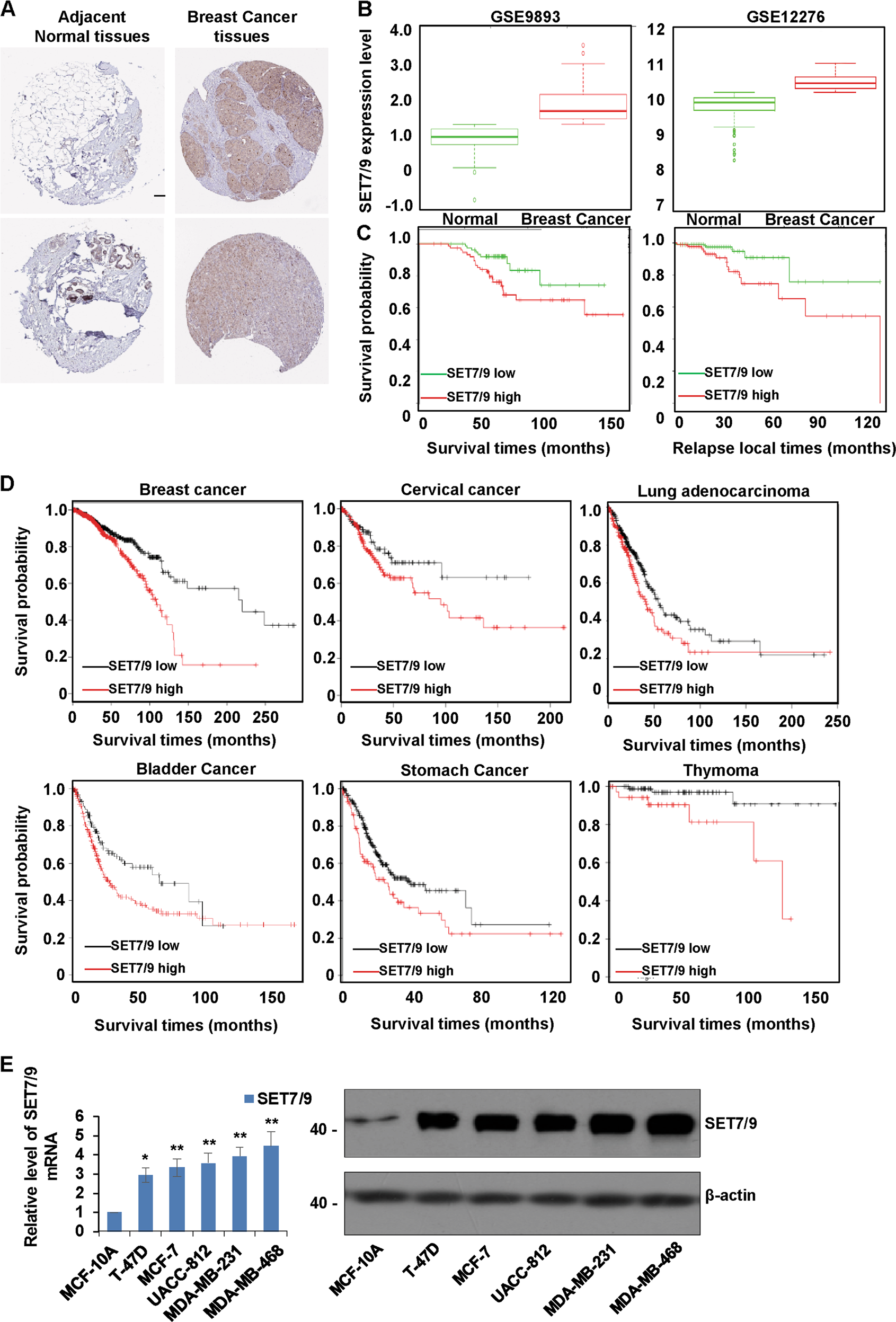 Fig. 1: SET7/9 is upregulated in breast cancer tissues and predicts a worse prognosis.