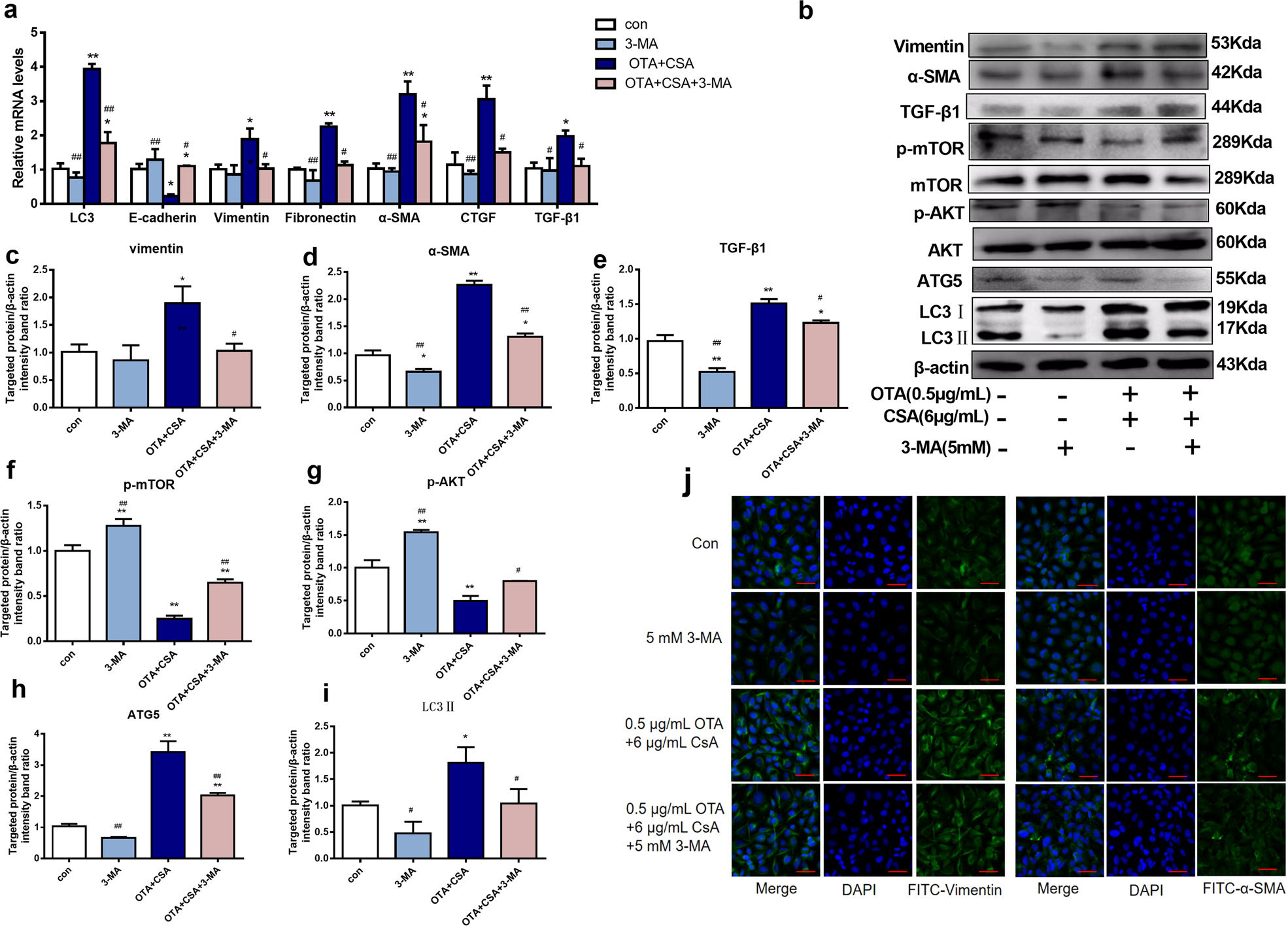 Fig. 6: Inhibition of autophagy alleviated the toxicities induced by low concentrations combination of OTA and CsA in HK-2 cells.