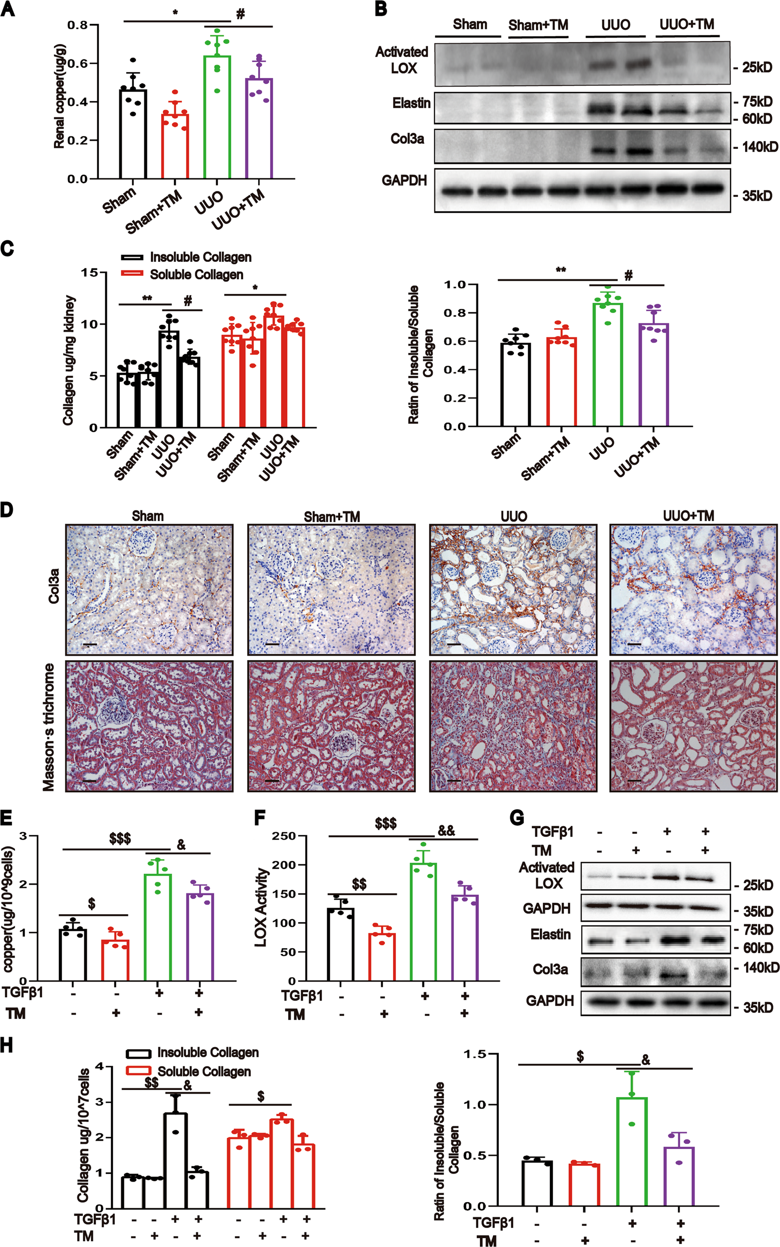 Fig. 5: Chelating copper decreased LOX activity and ameliorated renal fibrosis.