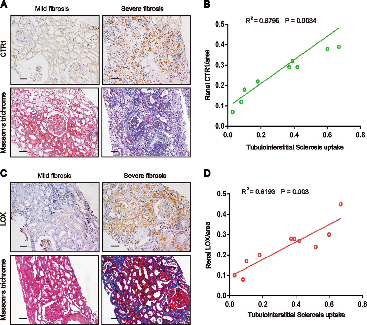 Fig. 6: Renal CTR1 and LOX levels correlate with the severity of renal fibrosis in patients.