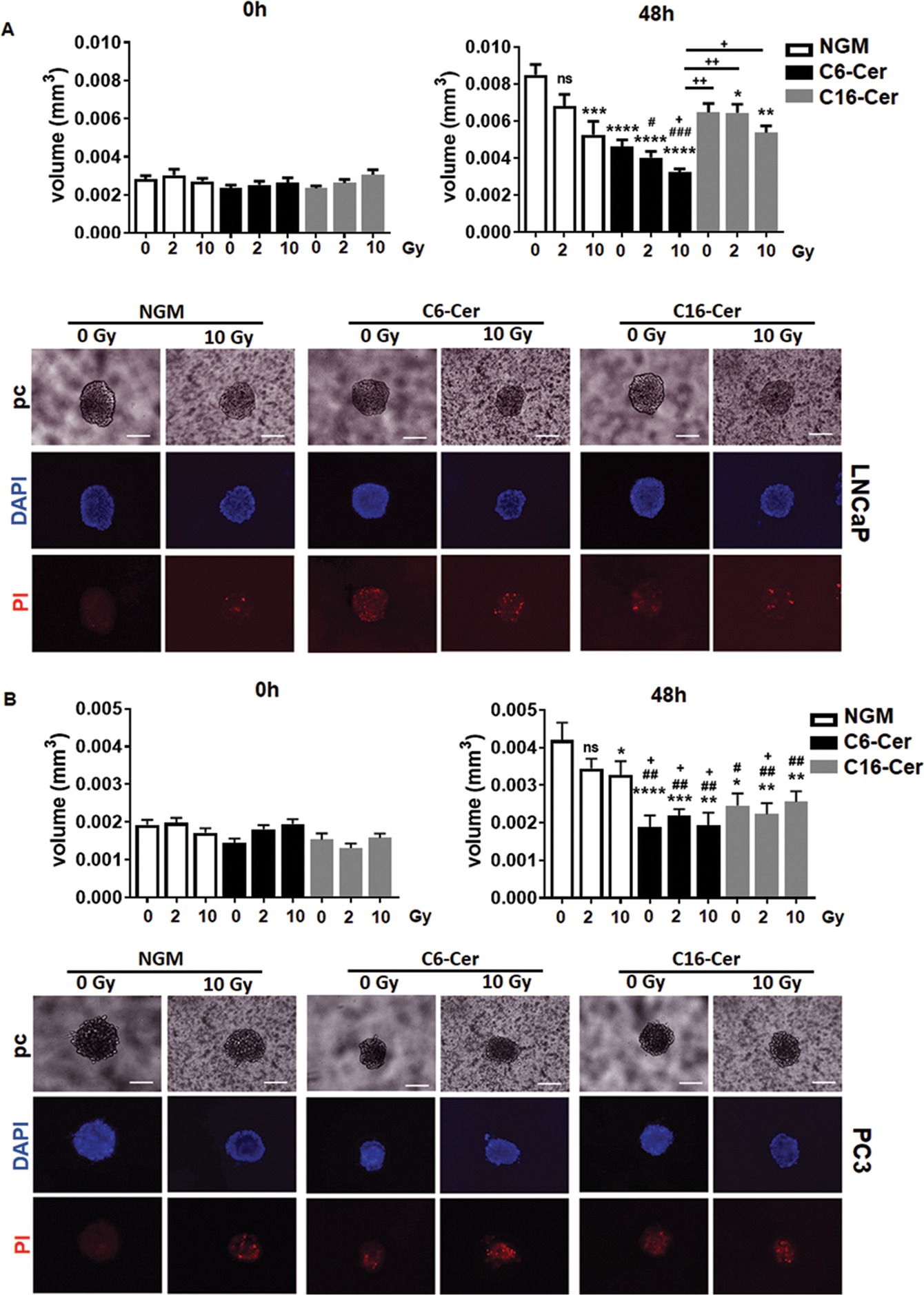 Fig. 5: Exogenous ceramide treatment induced PCa cell growth retardation and cell death.