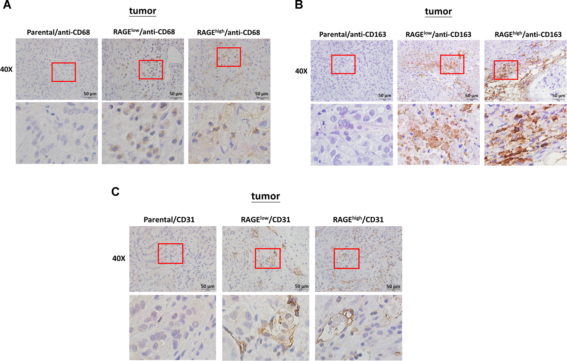 Fig. 6: The effects of RAGE on TAM infiltration in xenograft model.