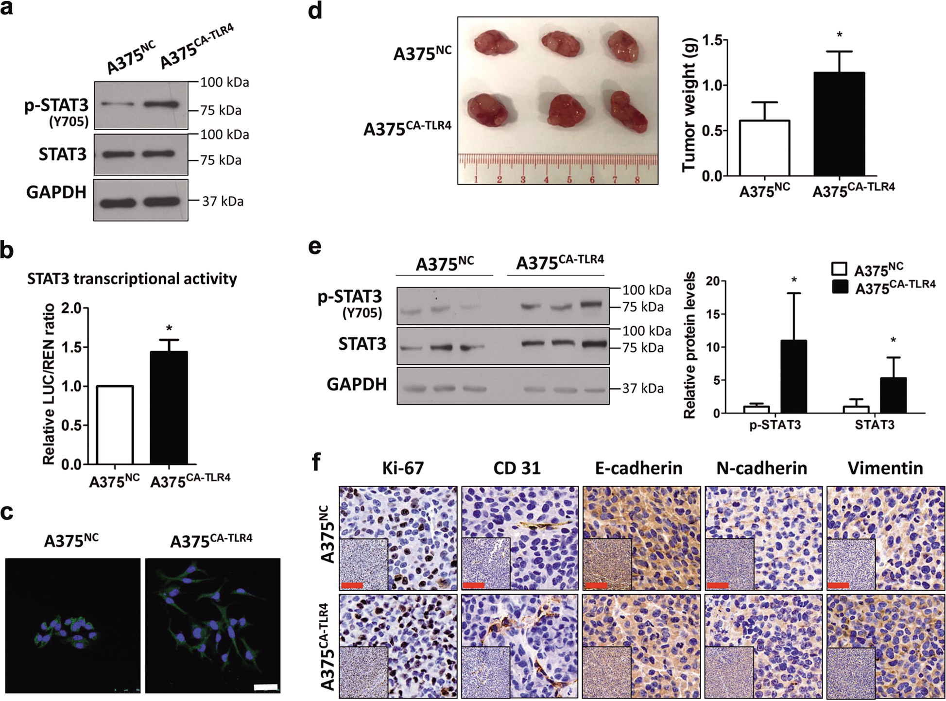 Fig. 4: Constitutive TLR4 signaling enhances STAT3 activation and promotes tumor growth, angiogenesis and EMT in mice.