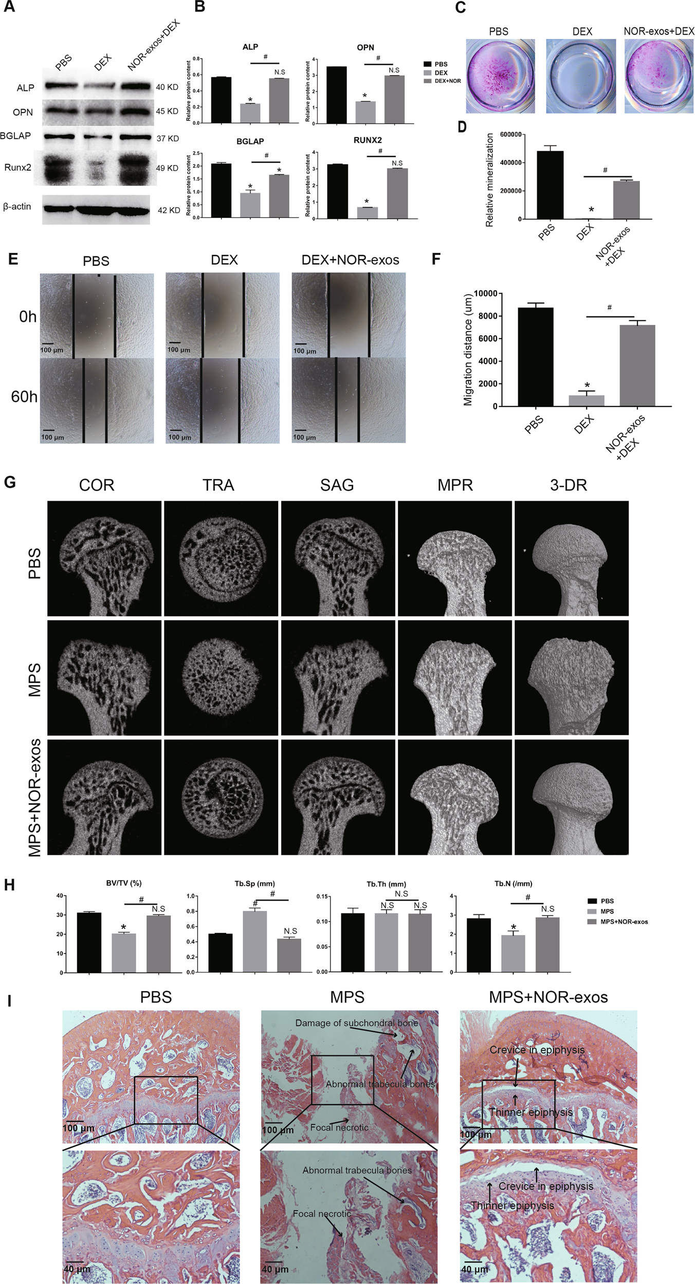 Fig. 8: The therapeutic effect of NOR-exos on GC-induced ONFH.