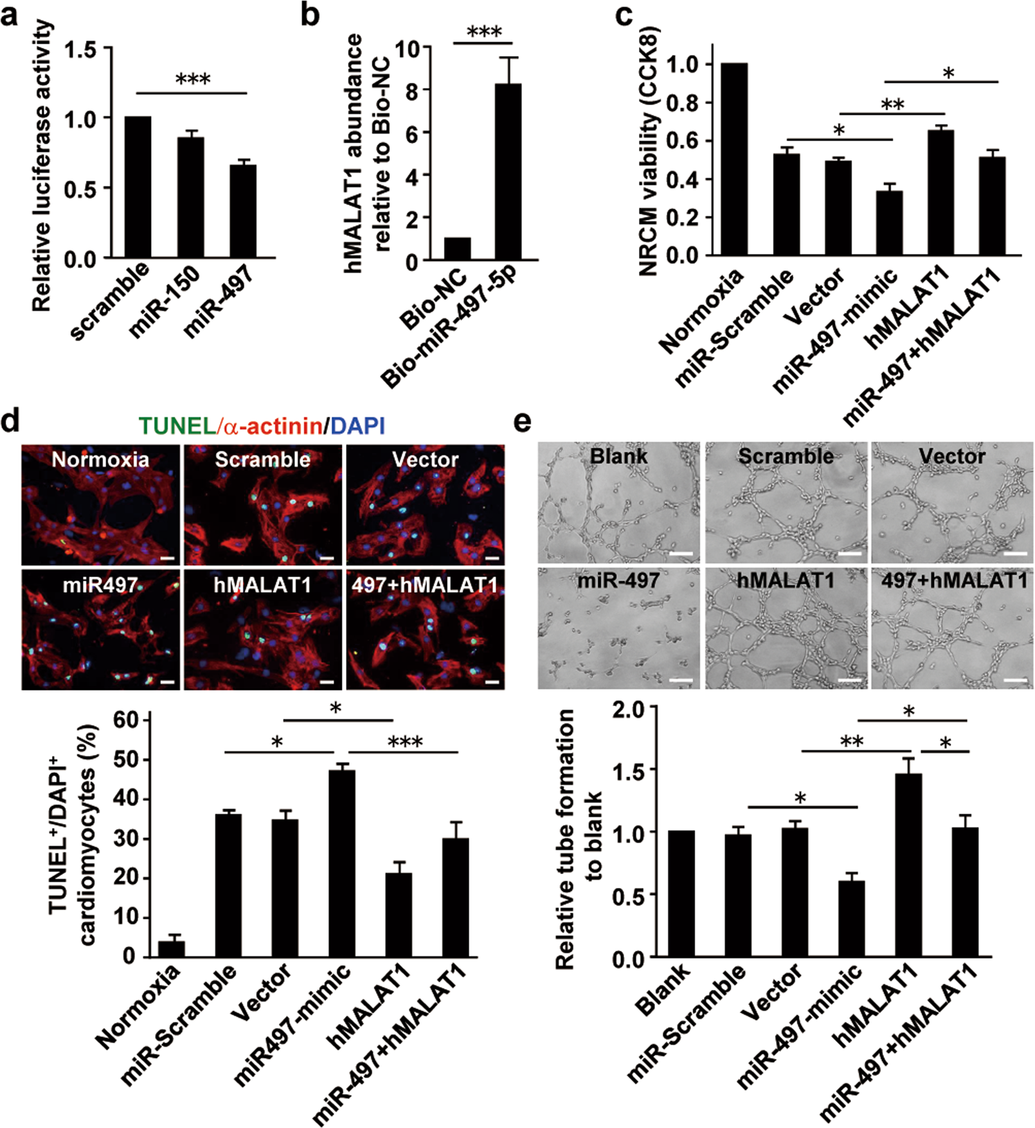 Fig. 7: MALAT1 cancels the pro-cardiomyocyte-death effect and suppress-angiogenesis effect of miR497.
