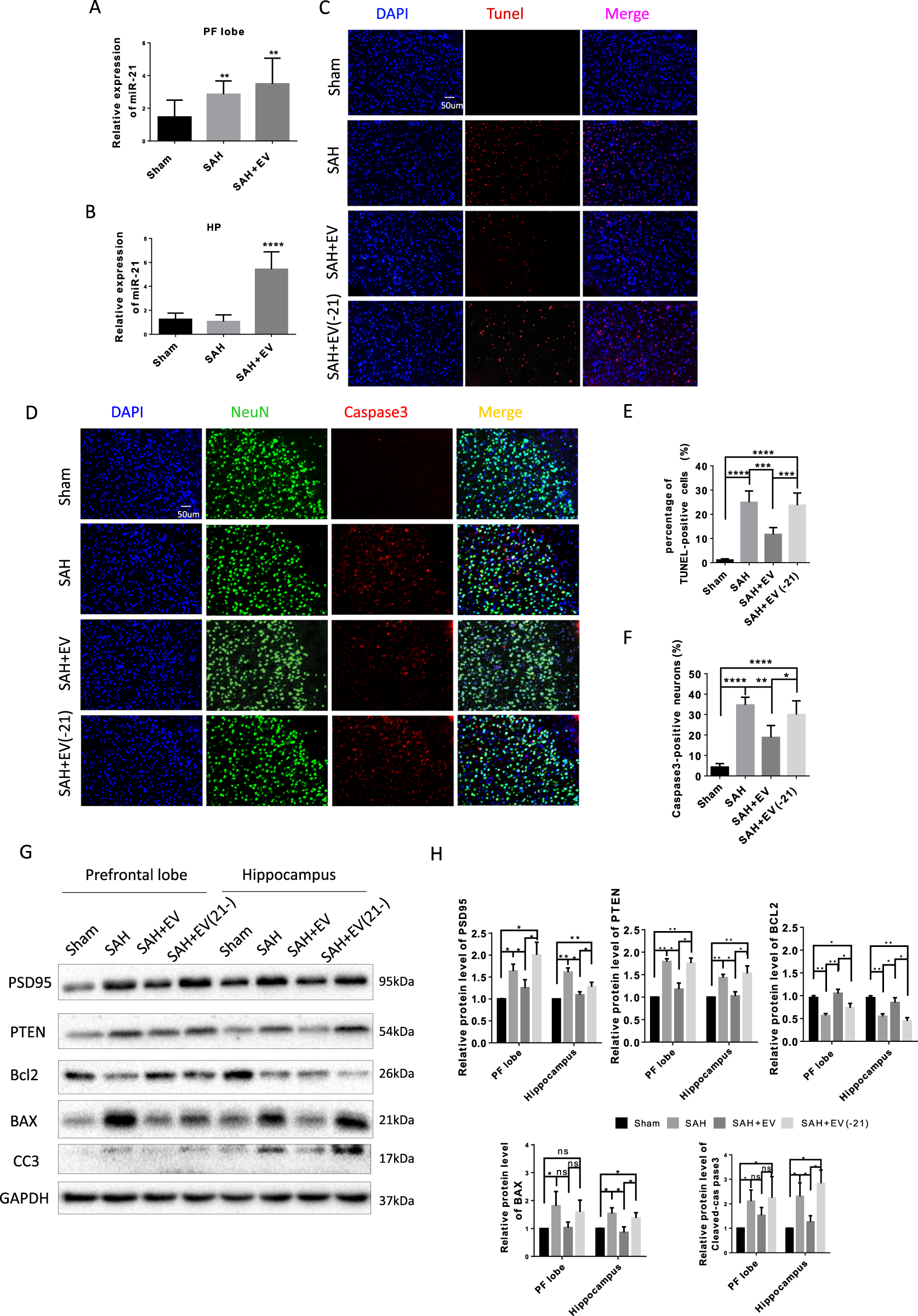 Fig. 6: miR-21 mediated the neuroprotective effects of MSC-EV.